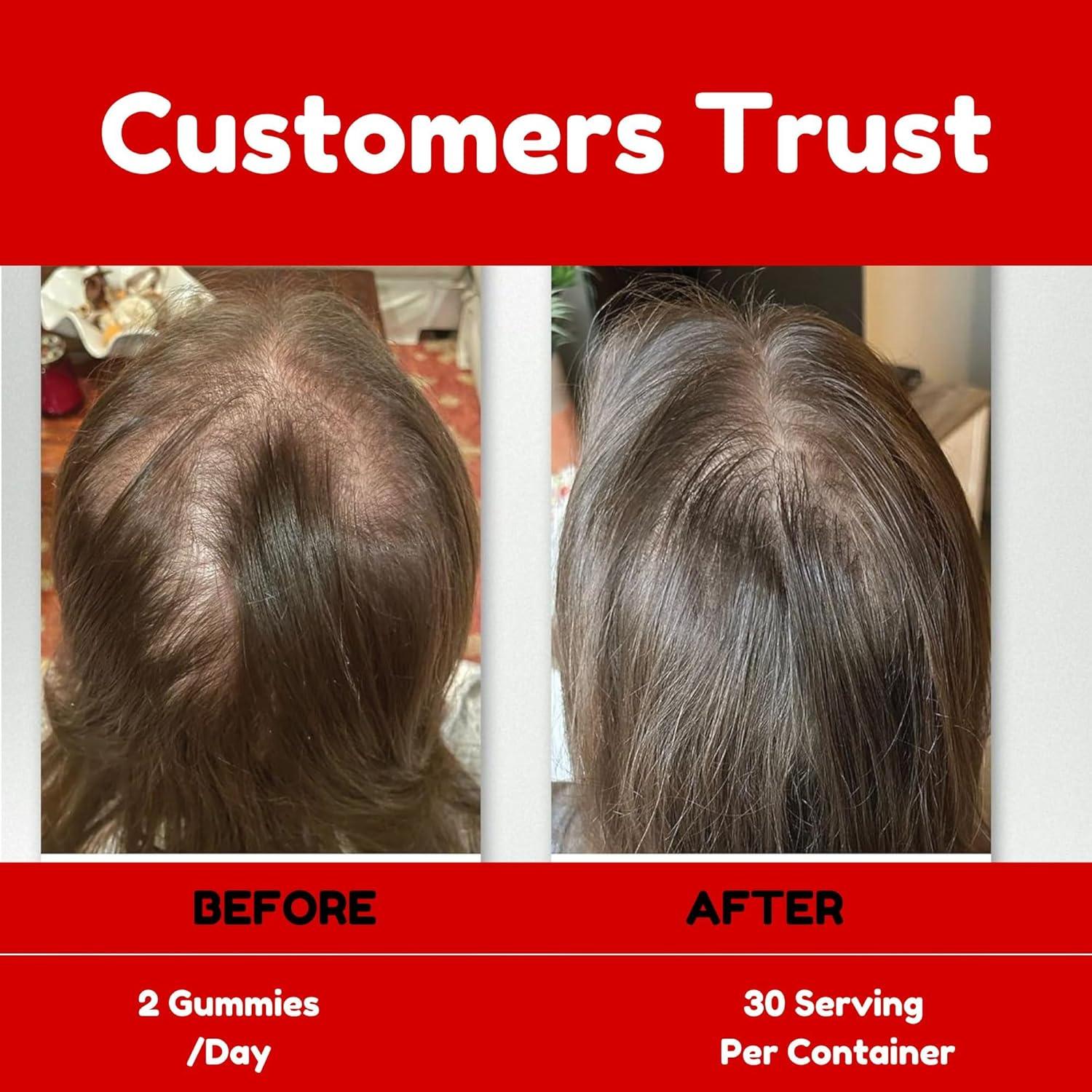 Gomitas de Aceite de Semilla de Calabaza Power Grain 4000mg