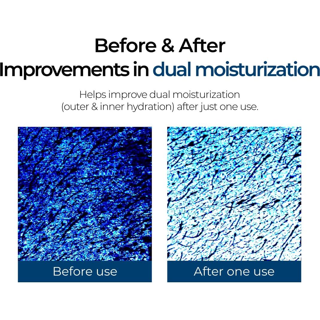 Suero Hidratante IZEZE Soul HNA 30ml - Ácido Hialurónico 8 Tipos