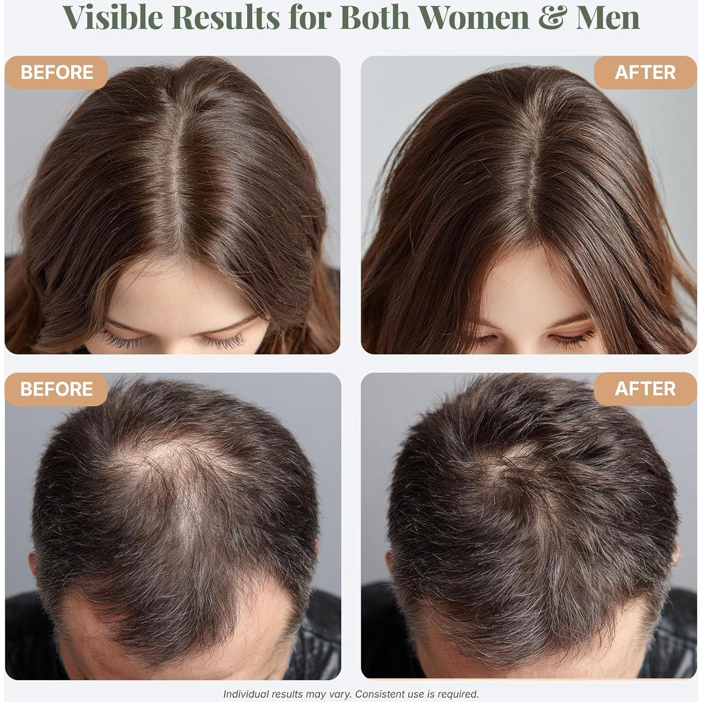 Aceite de Romero Orgánico El ÉLIX 113g - Crecimiento Cabello