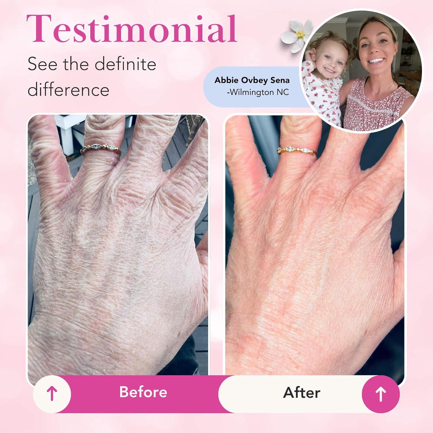 Theraplex Loción Clara Spray 227g - Aceite de Jojoba Natural