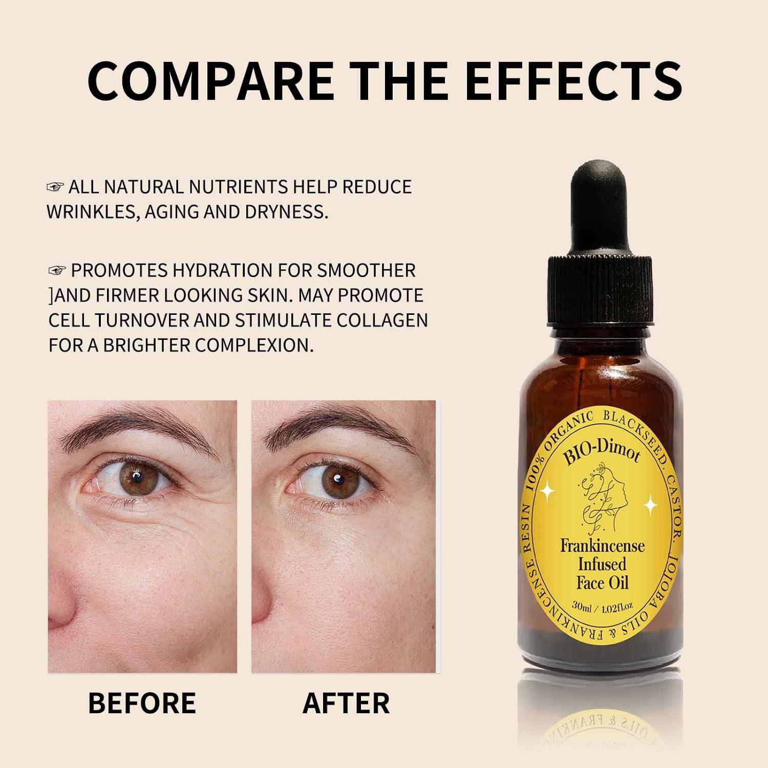 Aceite Facial Orgánico de Incienso LOYOTICE 30ml Hidratante Anti-Envejecimiento