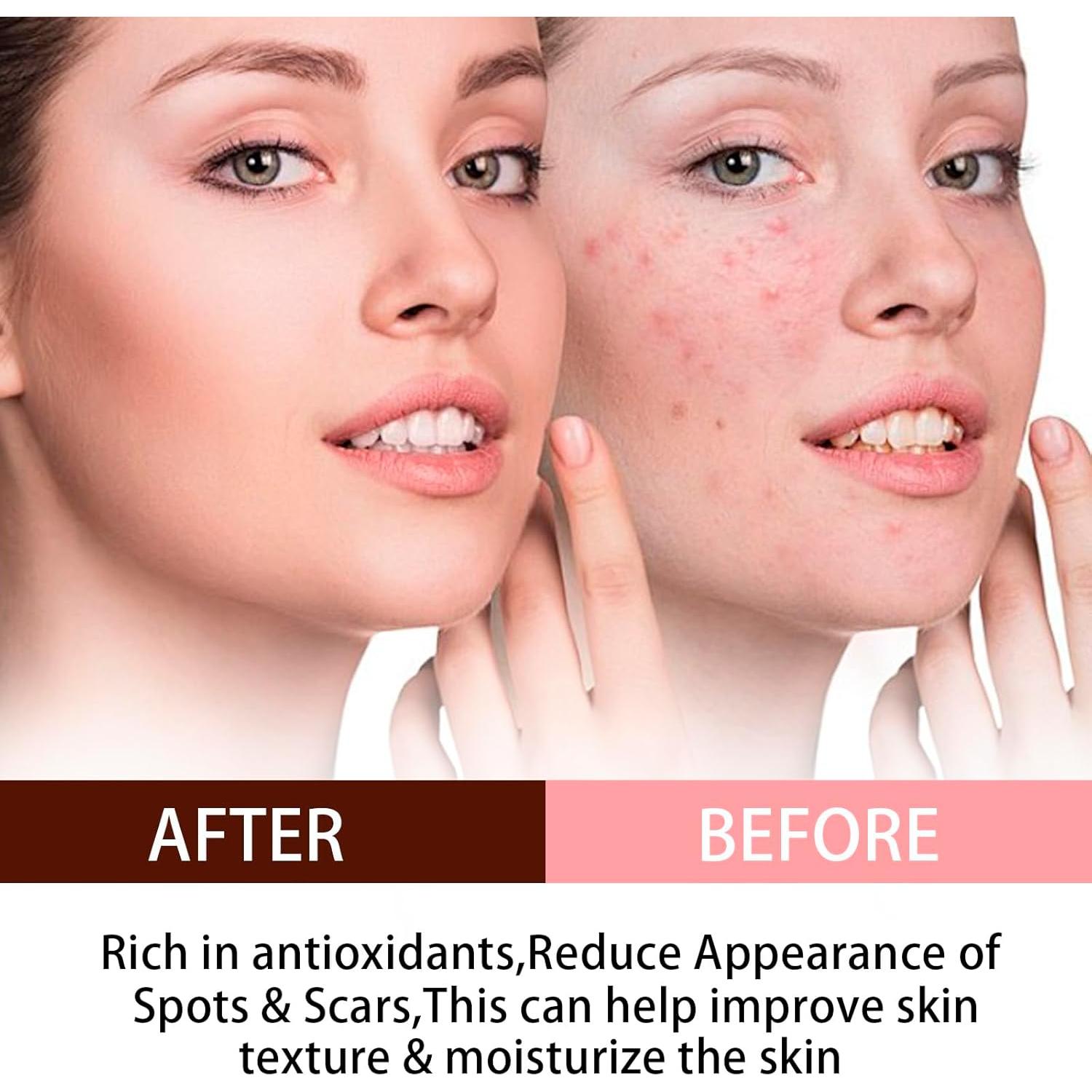 Aceite de Semilla de Rosa Mosqueta Orgánico 120ml - Antienvejecimiento