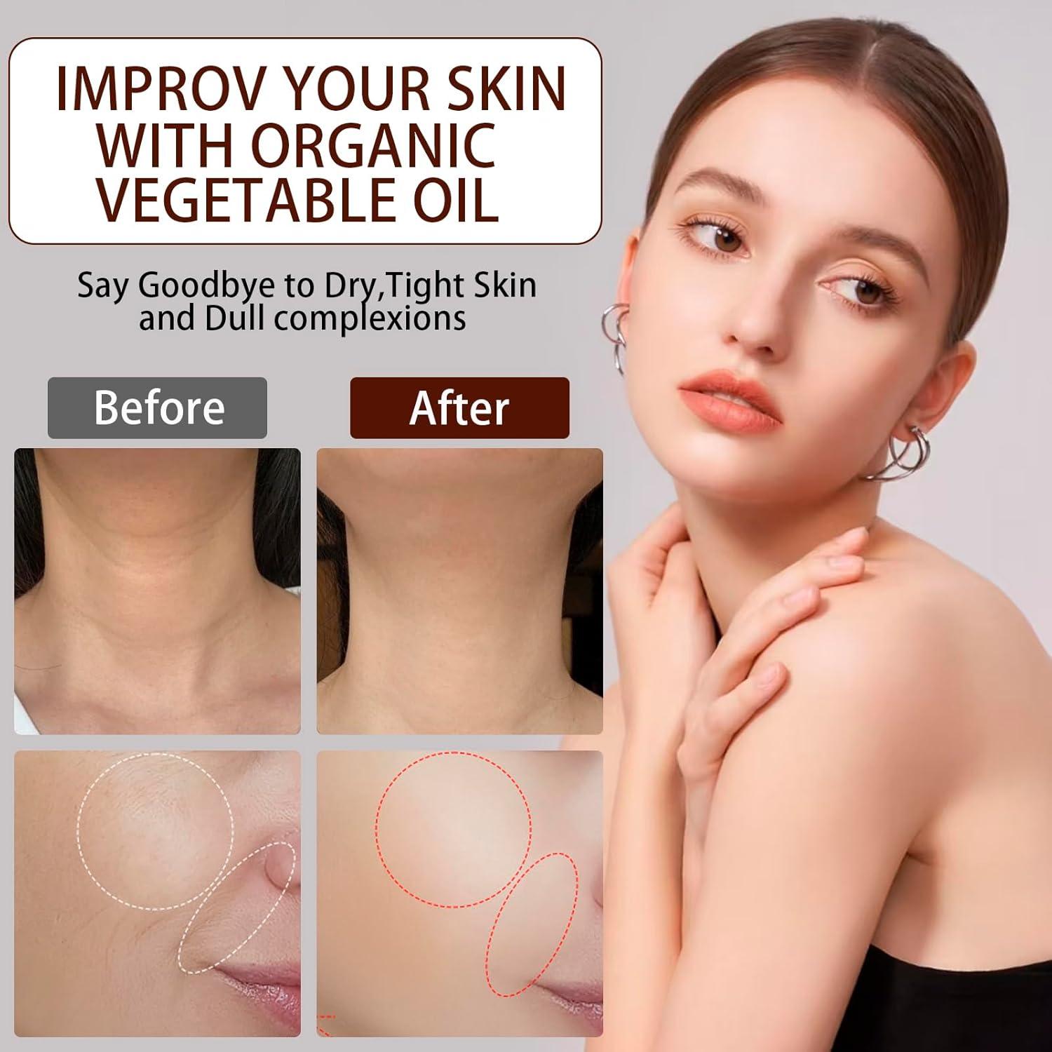 Aceite de Semilla de Rosa Mosqueta Orgánico 120ml - Antienvejecimiento