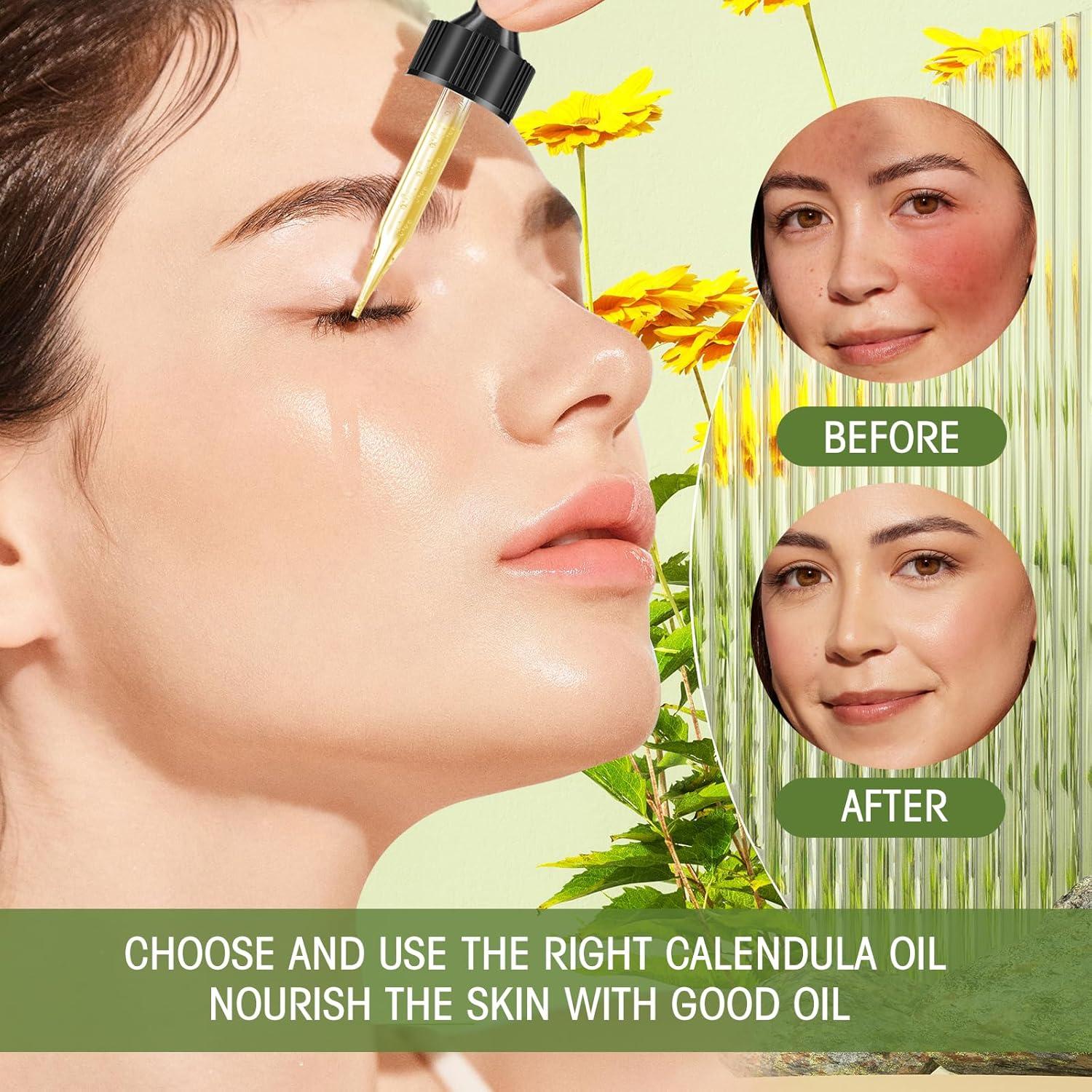 Aceite de Caléndula 100% Natural Bmrewax 29.57 ml - Antienvejecimiento y Hidratación