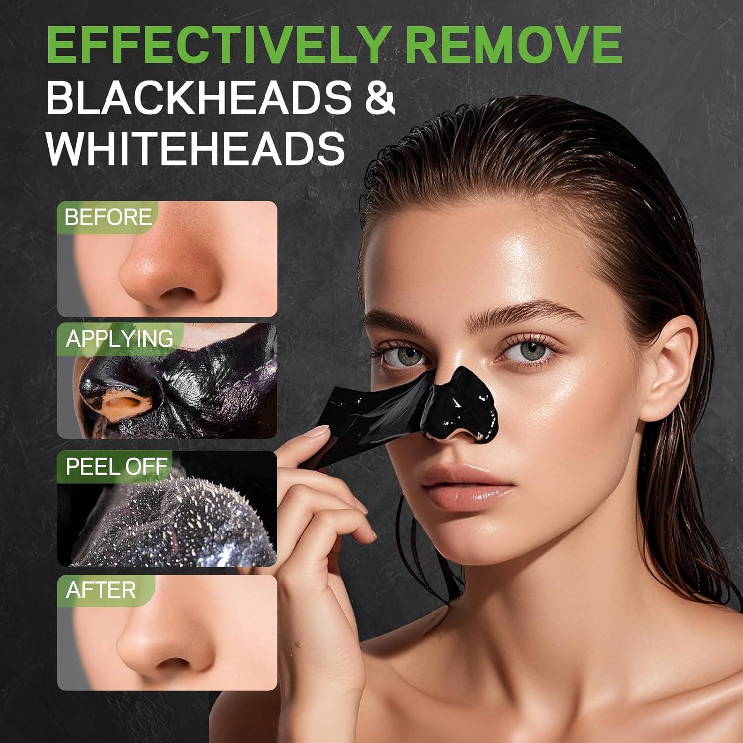 Máscara Peel-Off de Carbón AMOADO para Puntos Negros - Kit Completo