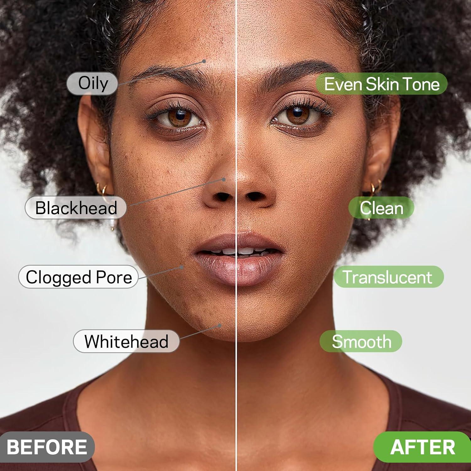 Máscara Peel-Off de Carbón AMOADO para Puntos Negros - Kit Completo