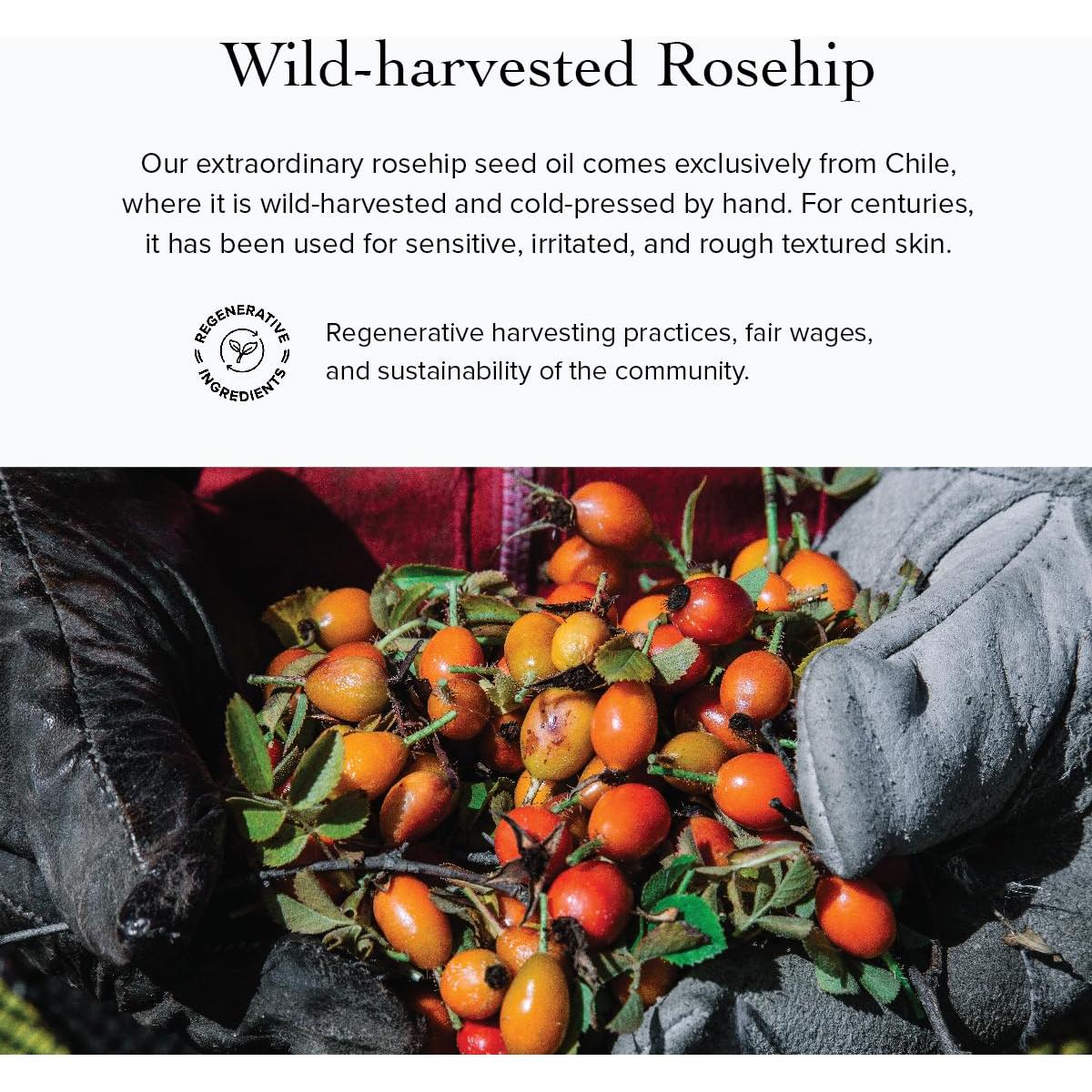 Suero Calmante de Rosa Mosqueta Evanhealy 11cm - Aceite Facial Orgánico