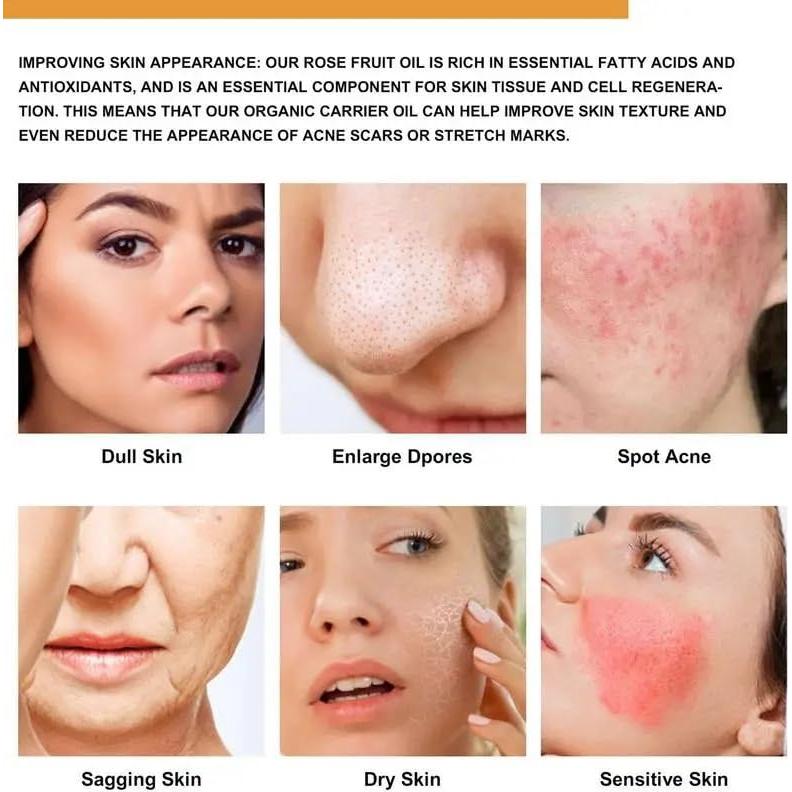 Aceite de Rosa Mosqueta Orgánico 30ml - WHHWM Hidratante Facial