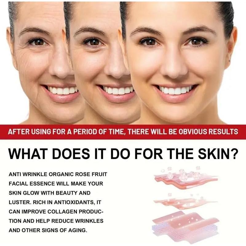 Aceite de Rosa Mosqueta Orgánico 30ml - WHHWM Hidratante Facial