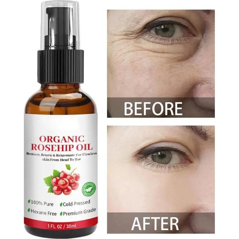 Aceite de Rosa Mosqueta Orgánico 30ml - WHHWM Hidratante Facial