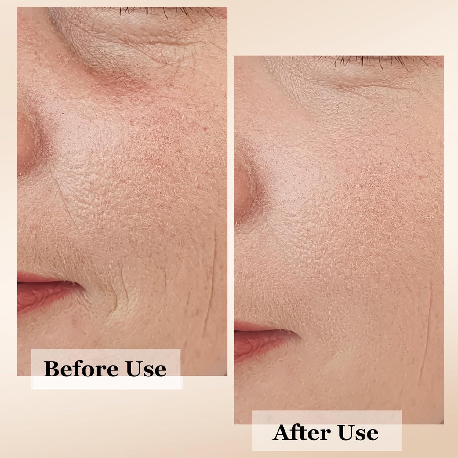 Suero Facial Antienvejecimiento mivida 30ml con Retinol y Vitamina C