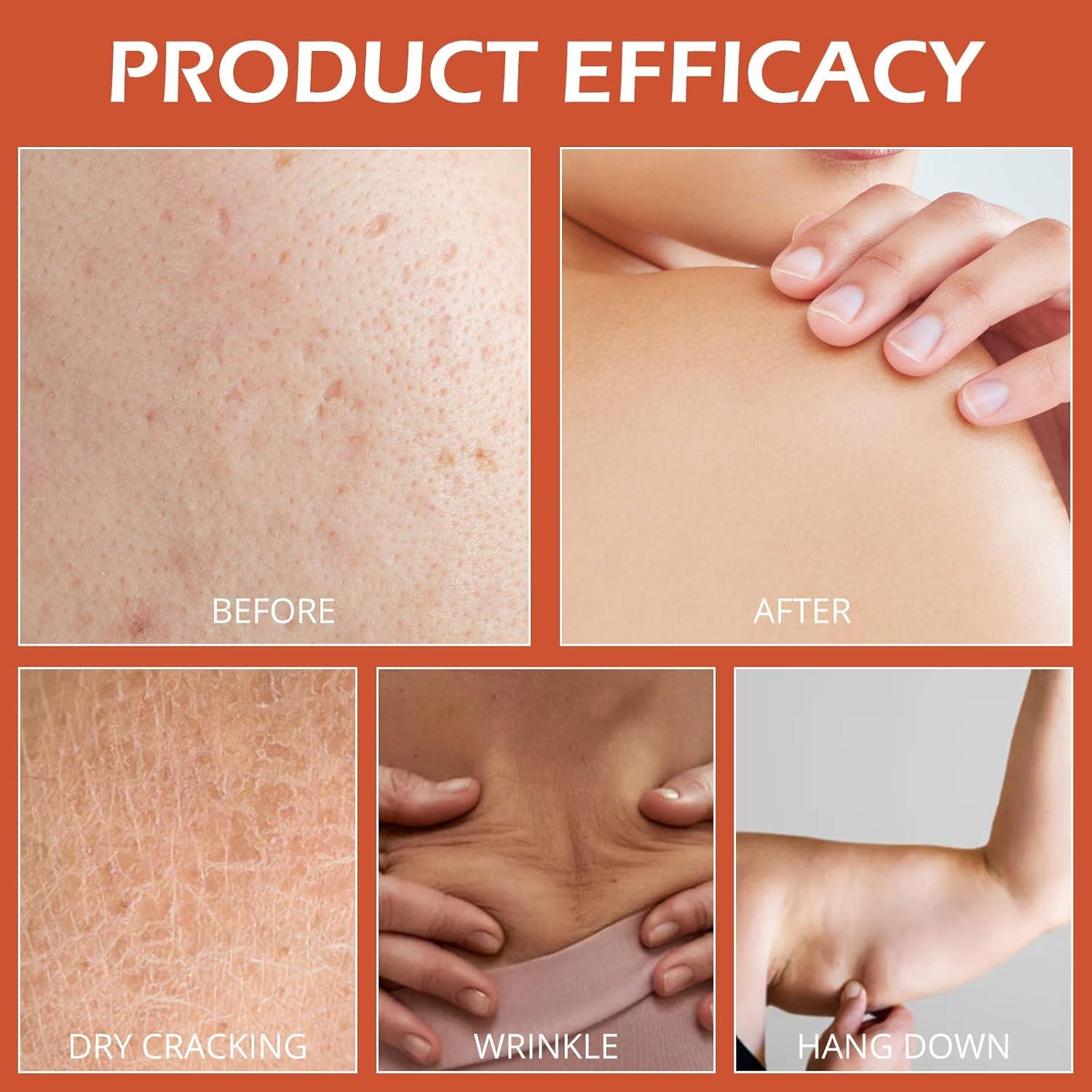 Aceite Reafirmante Hidratante Pewatul 100ml - Rosa Mosqueta y Almendra