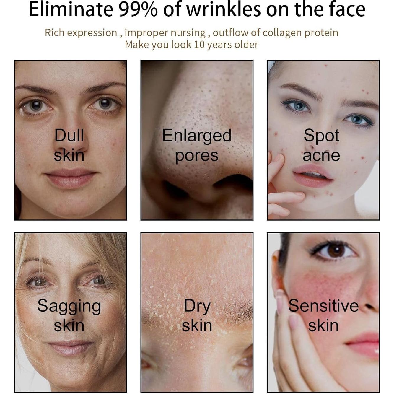 Suero Facial Hidratante Aiwen Chen - Aceite de Rosa Mosqueta 3Pcs