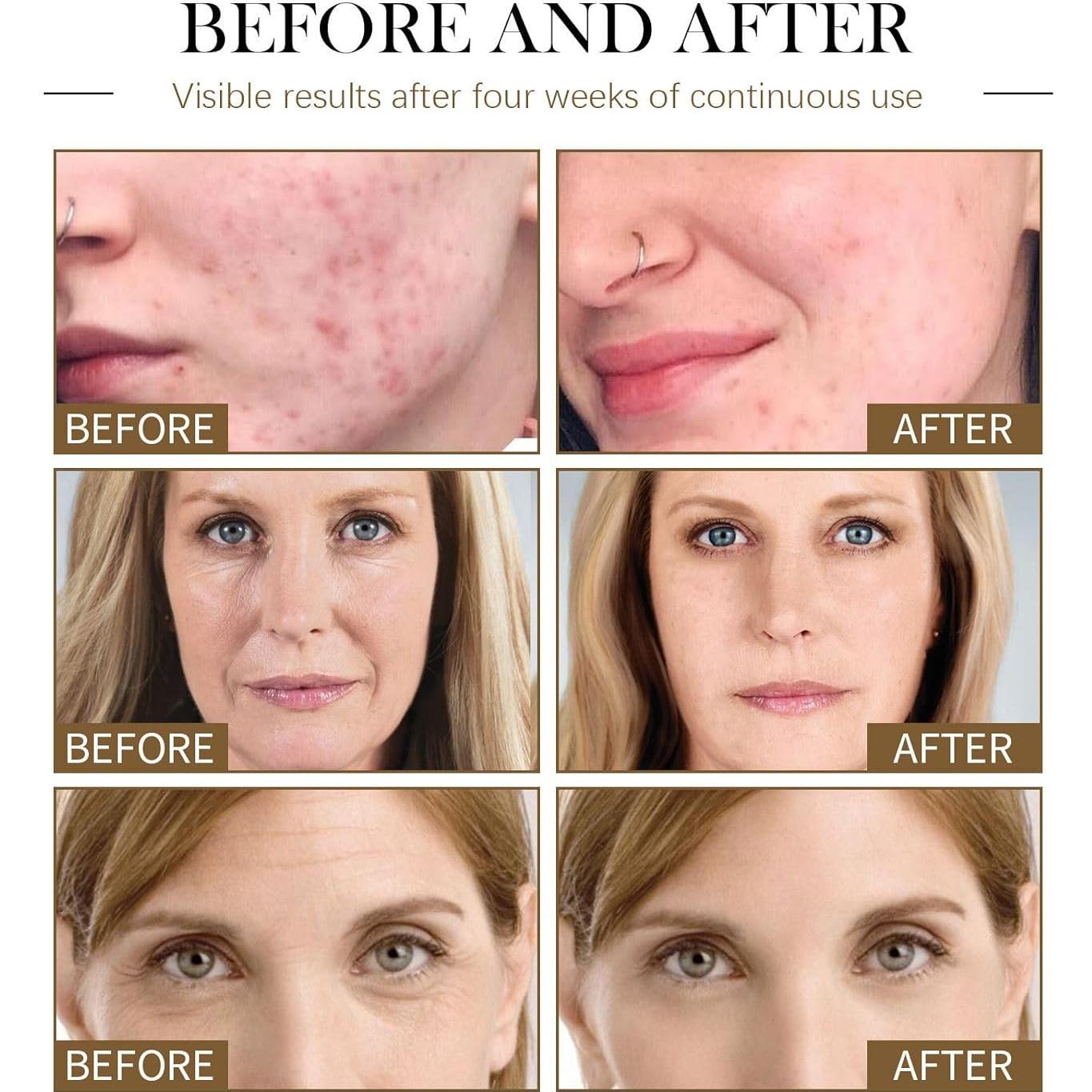 Suero Facial Hidratante Aiwen Chen - Aceite de Rosa Mosqueta 3Pcs