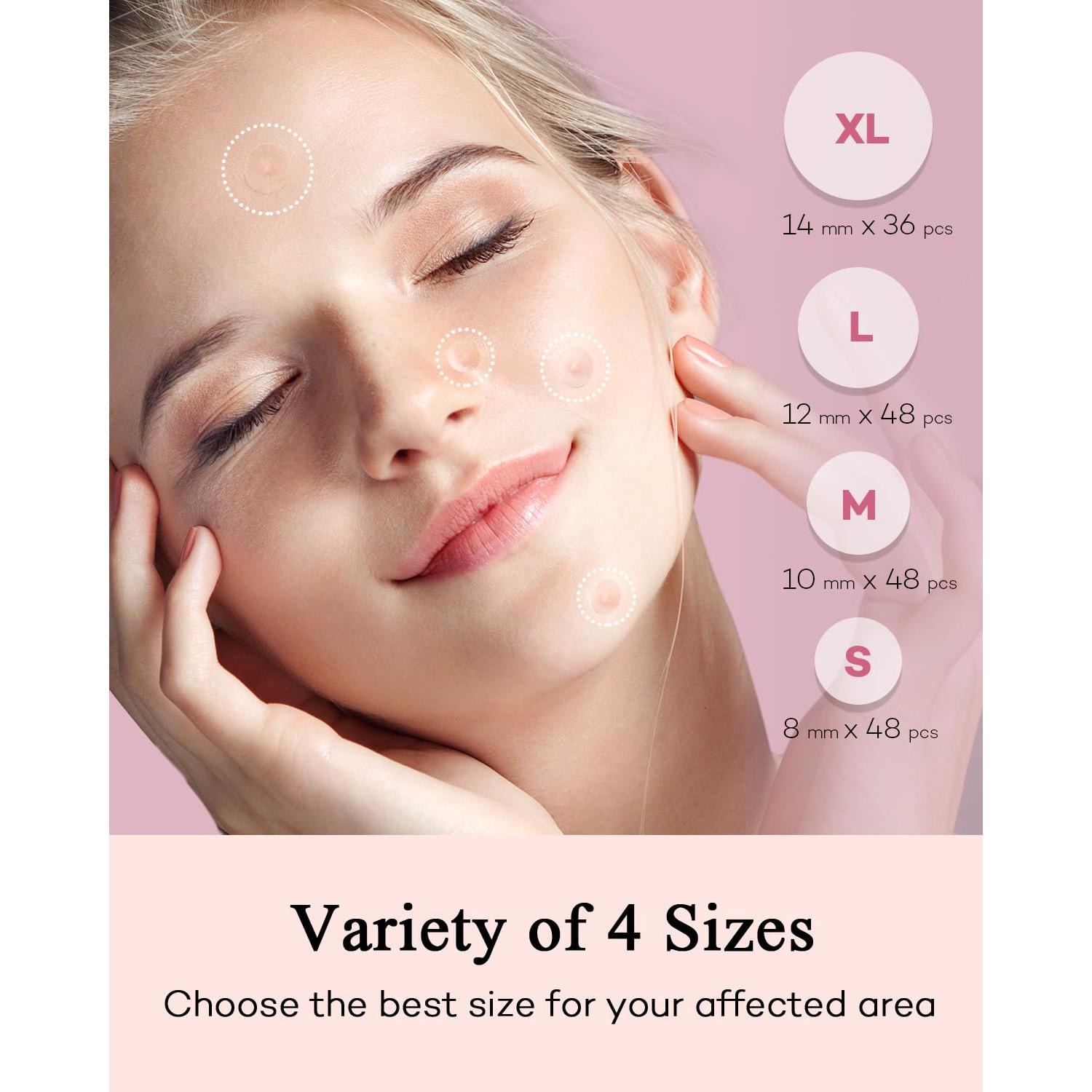 Parche Hidrocoloide para Acné TKTK - 180 Unidades, 4 Tamaños