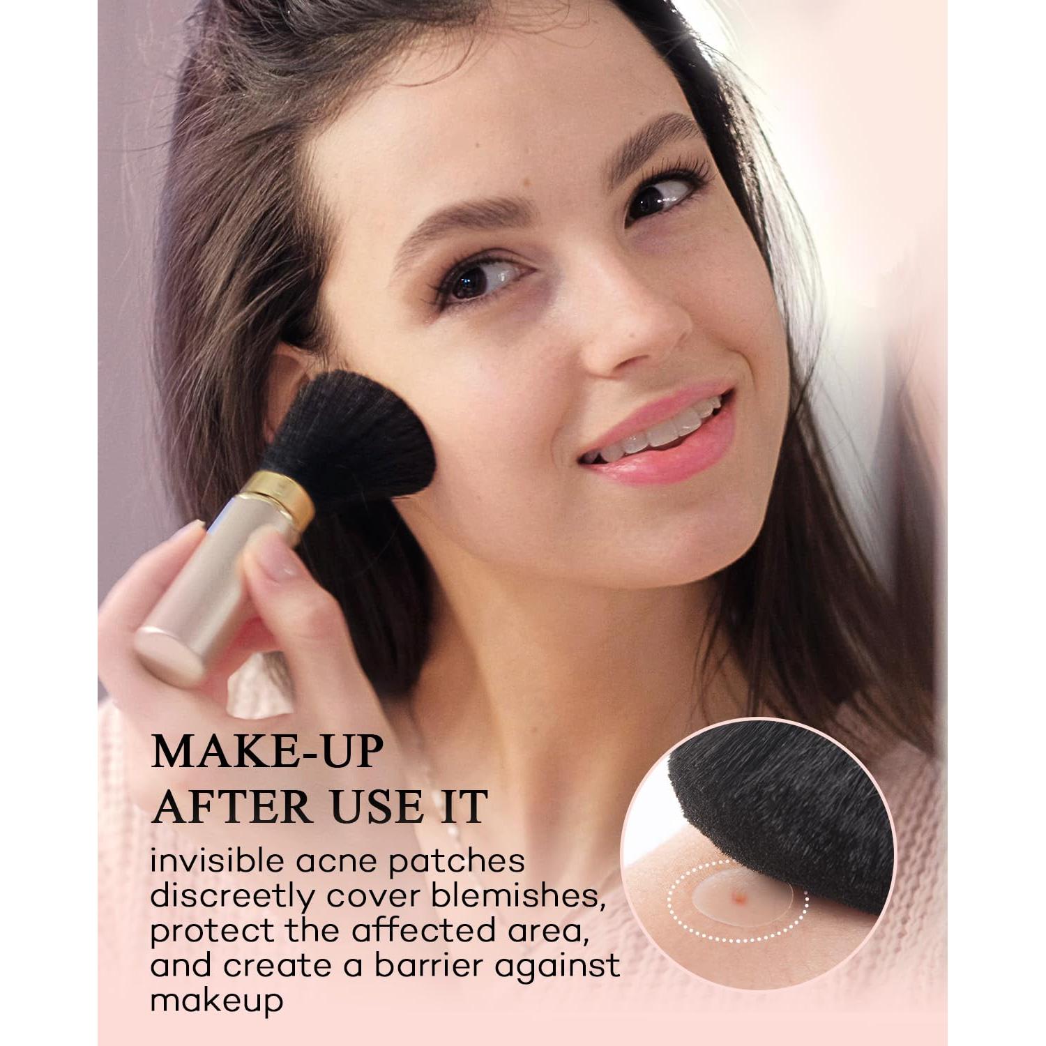 Parche Hidrocoloide para Acné TKTK - 180 Unidades, 4 Tamaños