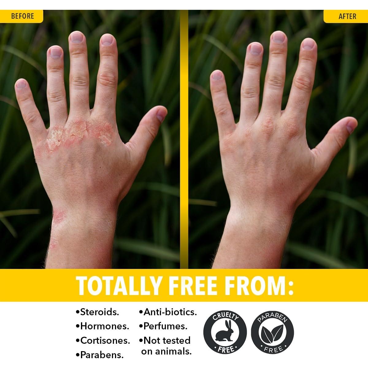 Jabón Limpiador Dr. Robaina con Azufre 113 g - Piel Grasa