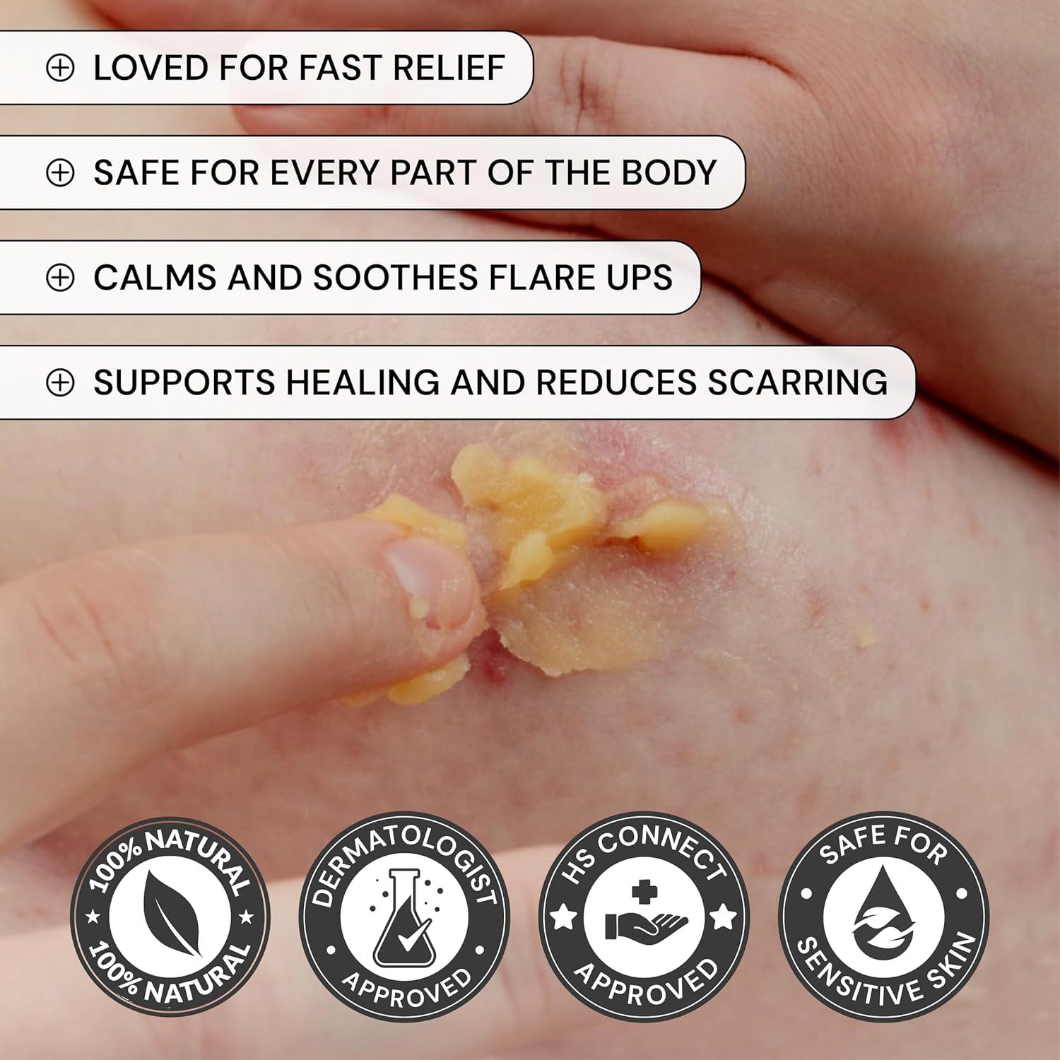 Cuidado de Piel MyMagicHealer 28.35 g - Alivio Natural Brotes