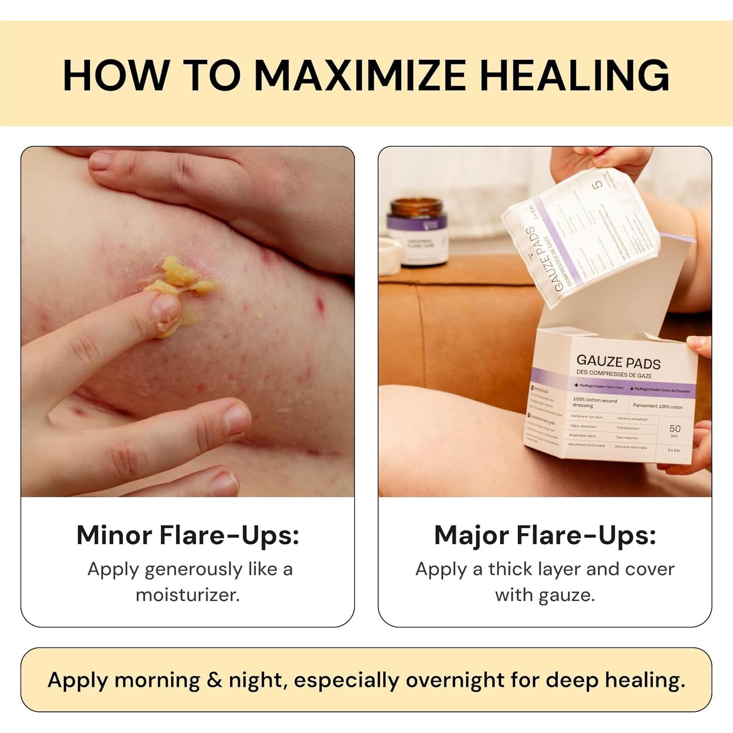 Cuidado de Piel MyMagicHealer 28.35 g - Alivio Natural Brotes