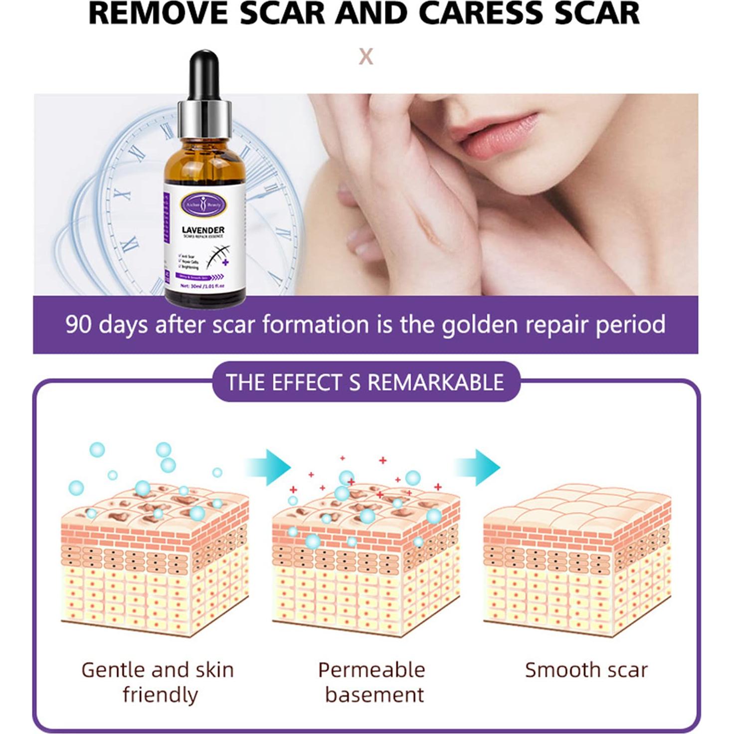 Esencia Reparadora de Cicatrices AICHUN BEAUTY 30ml Lavanda