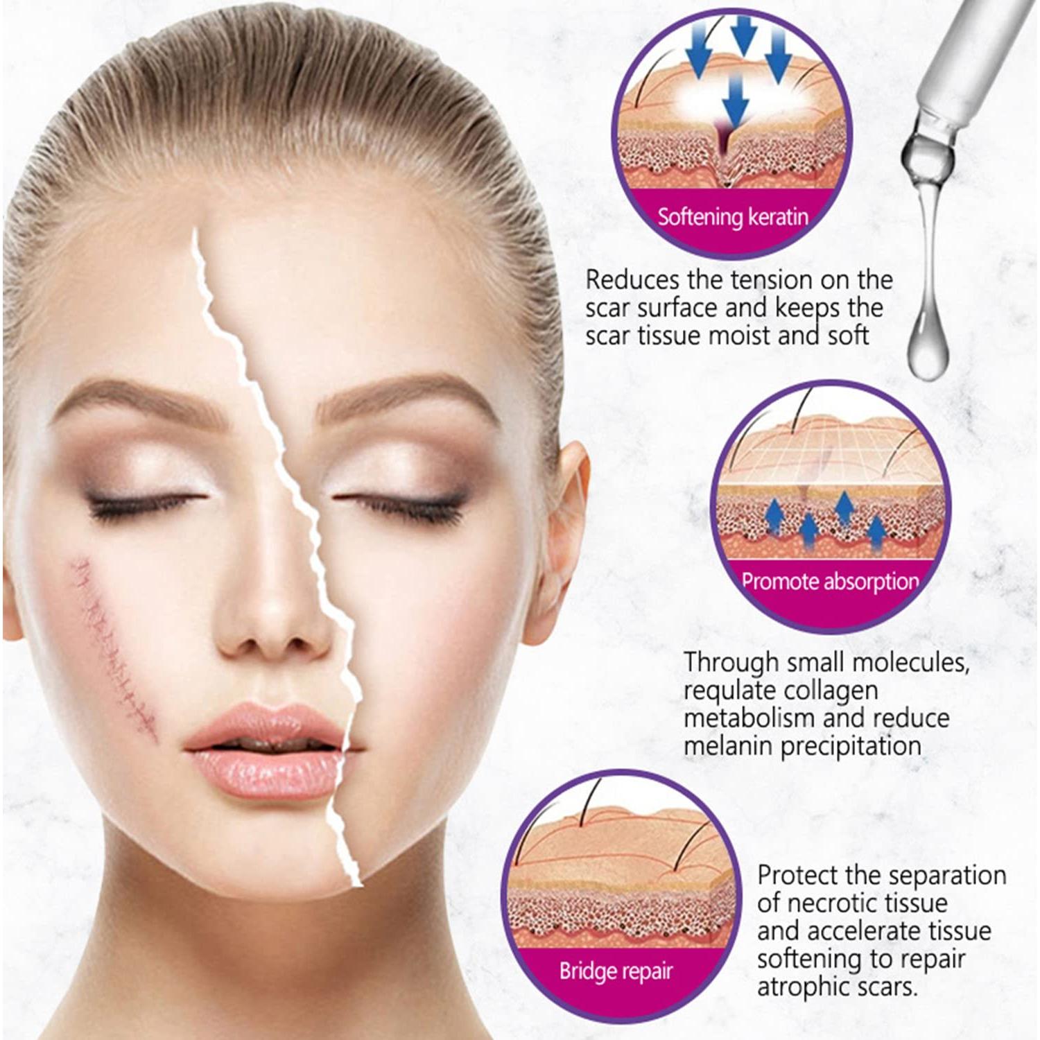 Esencia Reparadora de Cicatrices AICHUN BEAUTY 30ml Lavanda