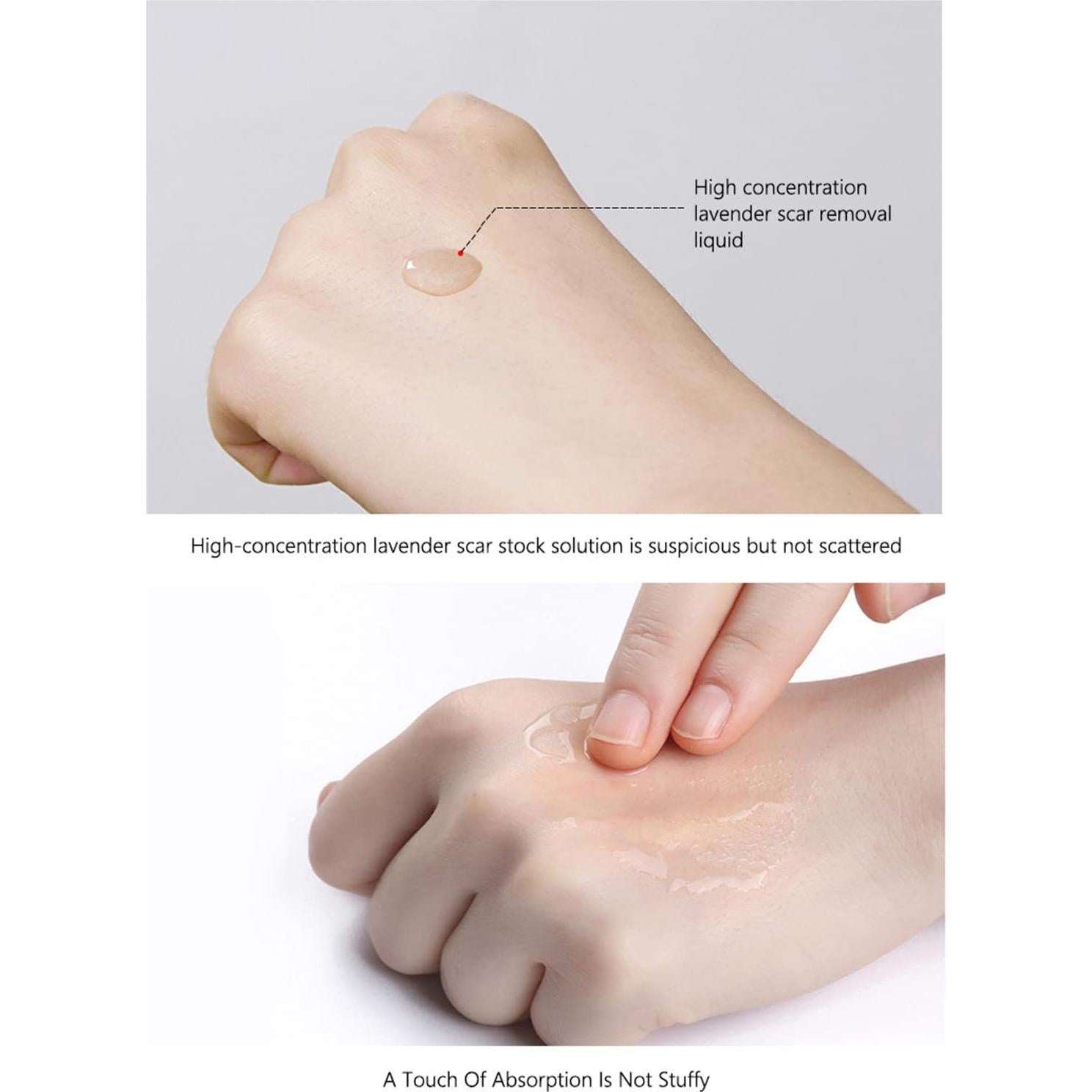 Esencia Reparadora de Cicatrices AICHUN BEAUTY 30ml Lavanda