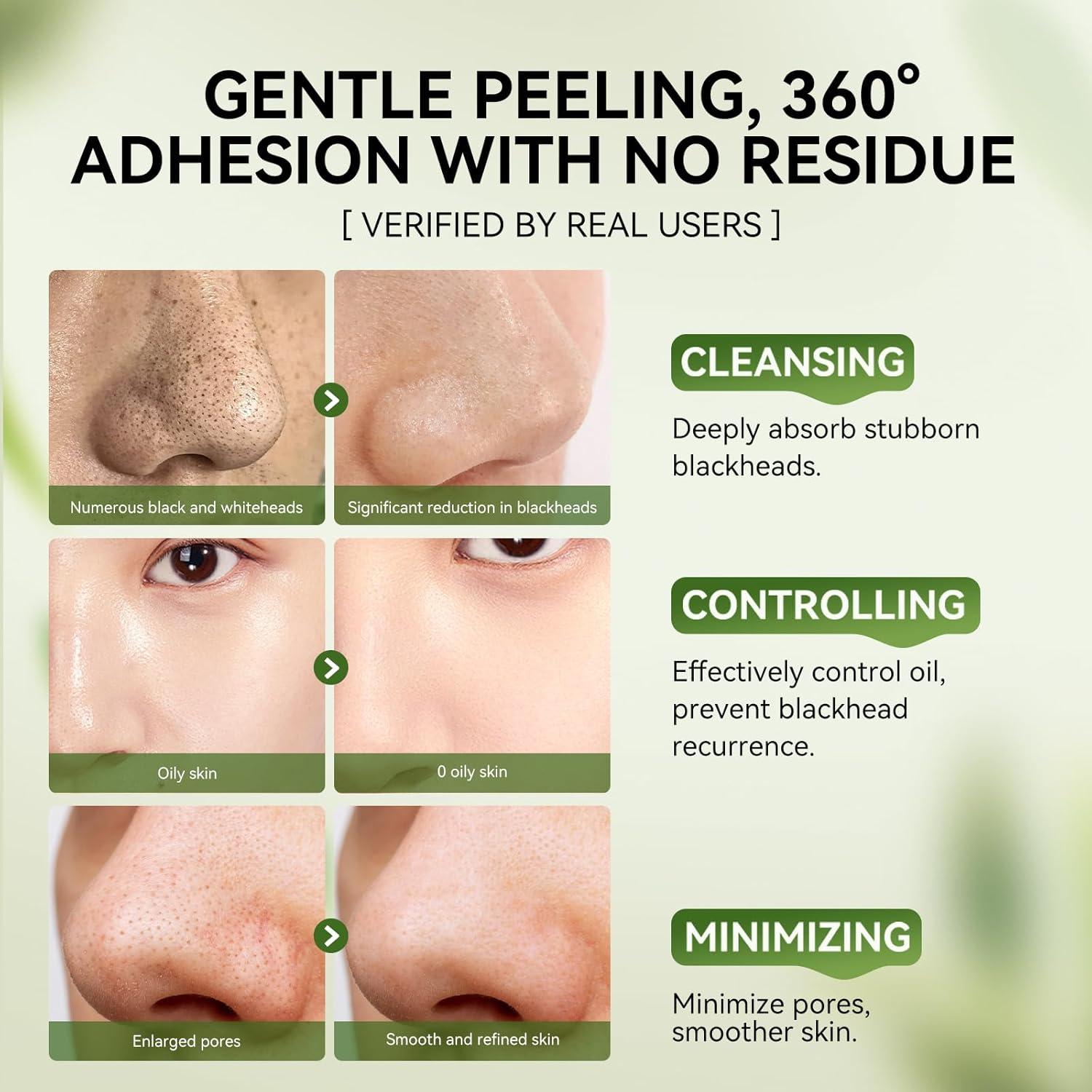 Kit LANBENA Tiras para Poros 2% Ácido Salicílico + Máscara Carbón