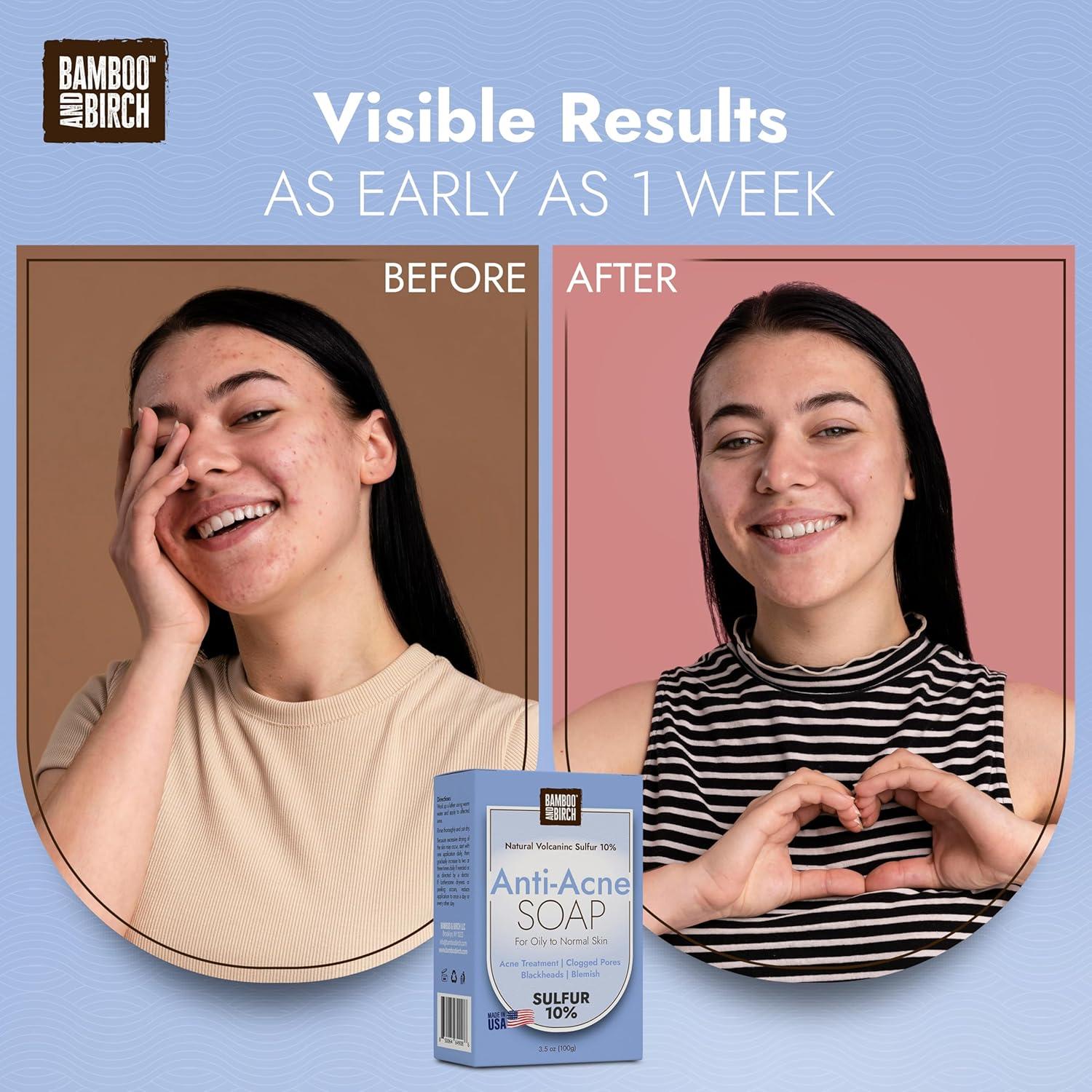 Jabón de Azufre Bamboo & Birch 10% 99.22 g Tratamiento Acné