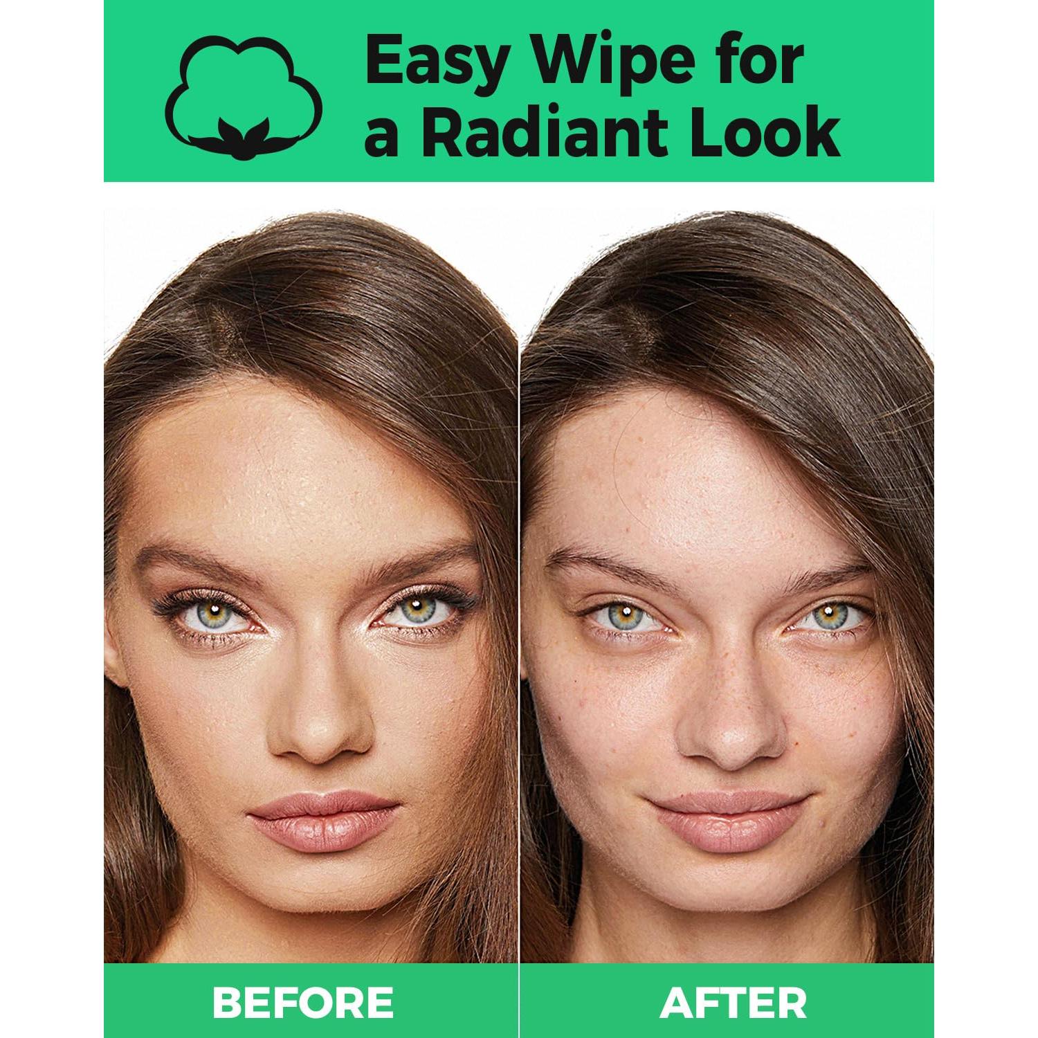 ProCIV Almohadillas Reutilizables de Algodón Orgánico 18 Pzas