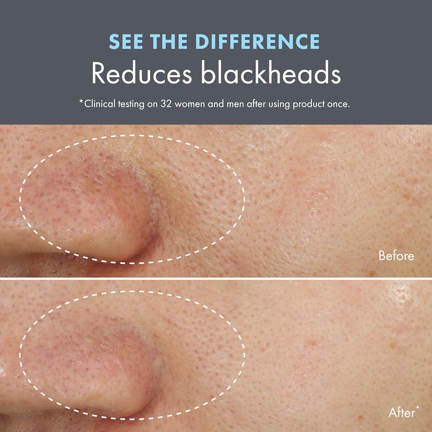 Mascarilla y Exfoliante Facial Origins Clear Improvement 73.93 ml