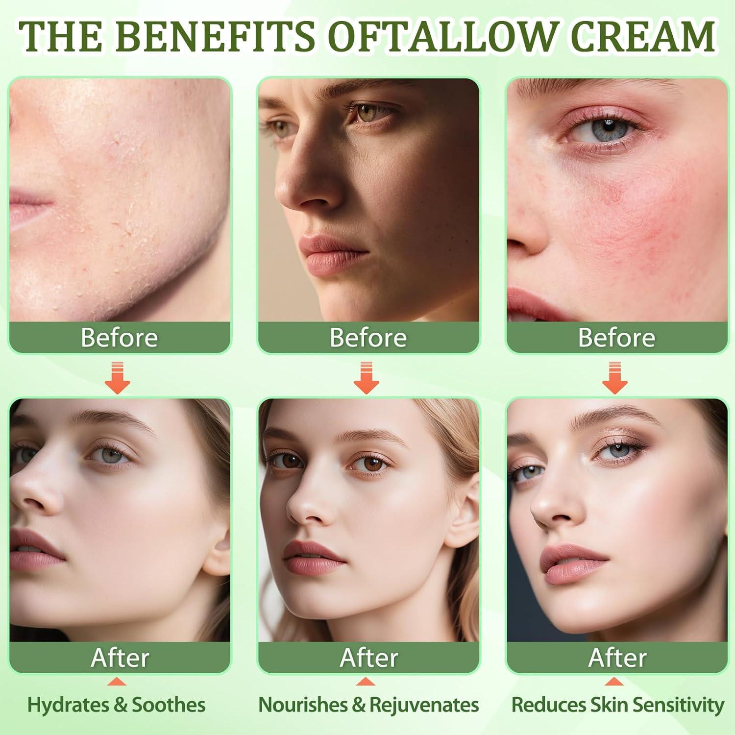 Crema Hidratante Facial de Grasa de Res GARPGONA Vainilla 240g