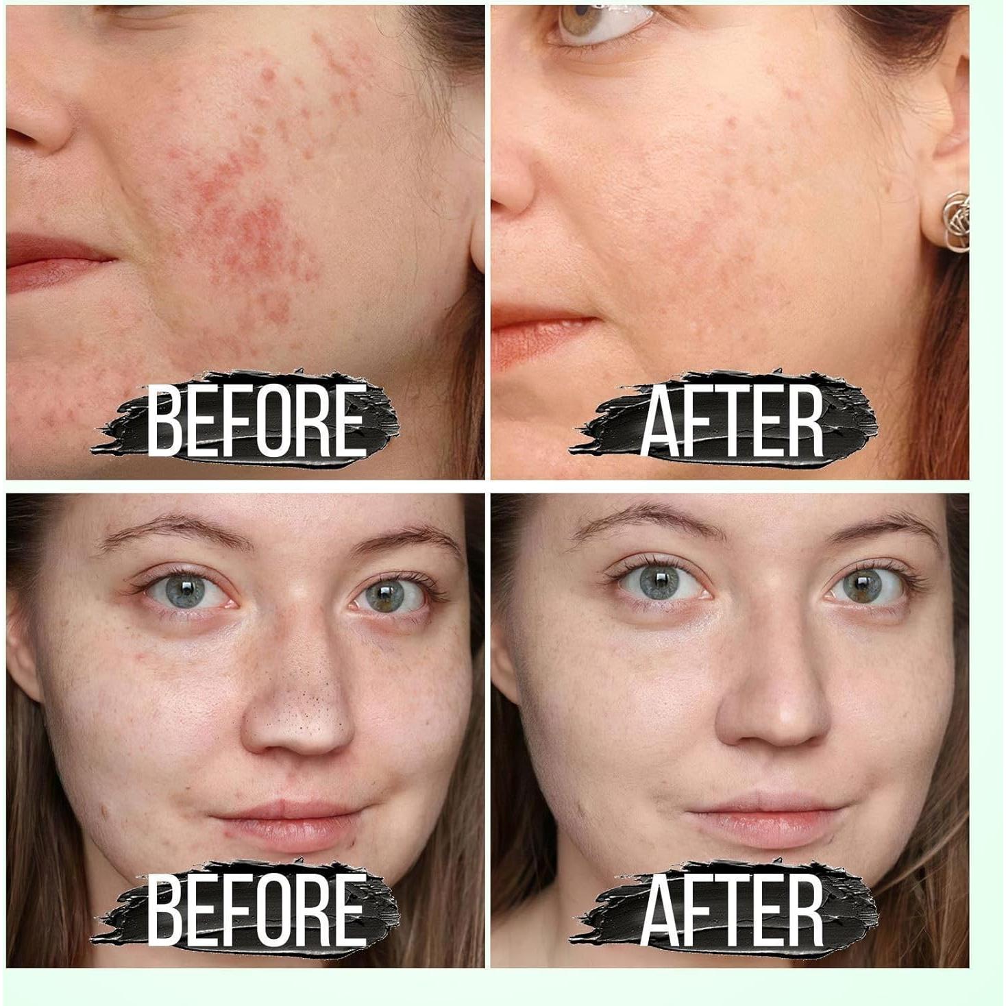 Mascarilla Quitacomedones Negra Peel Off PMRXSETD 68g