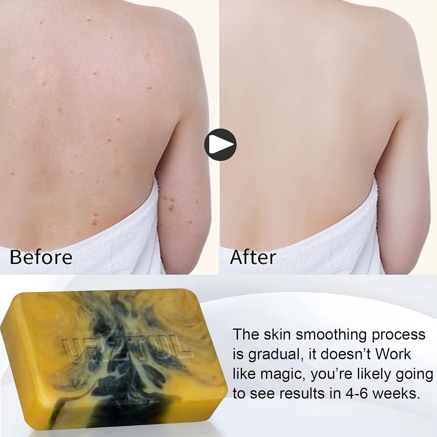 Jabón Natural de Carbón Activado URZTUL 3 Piezas 312g