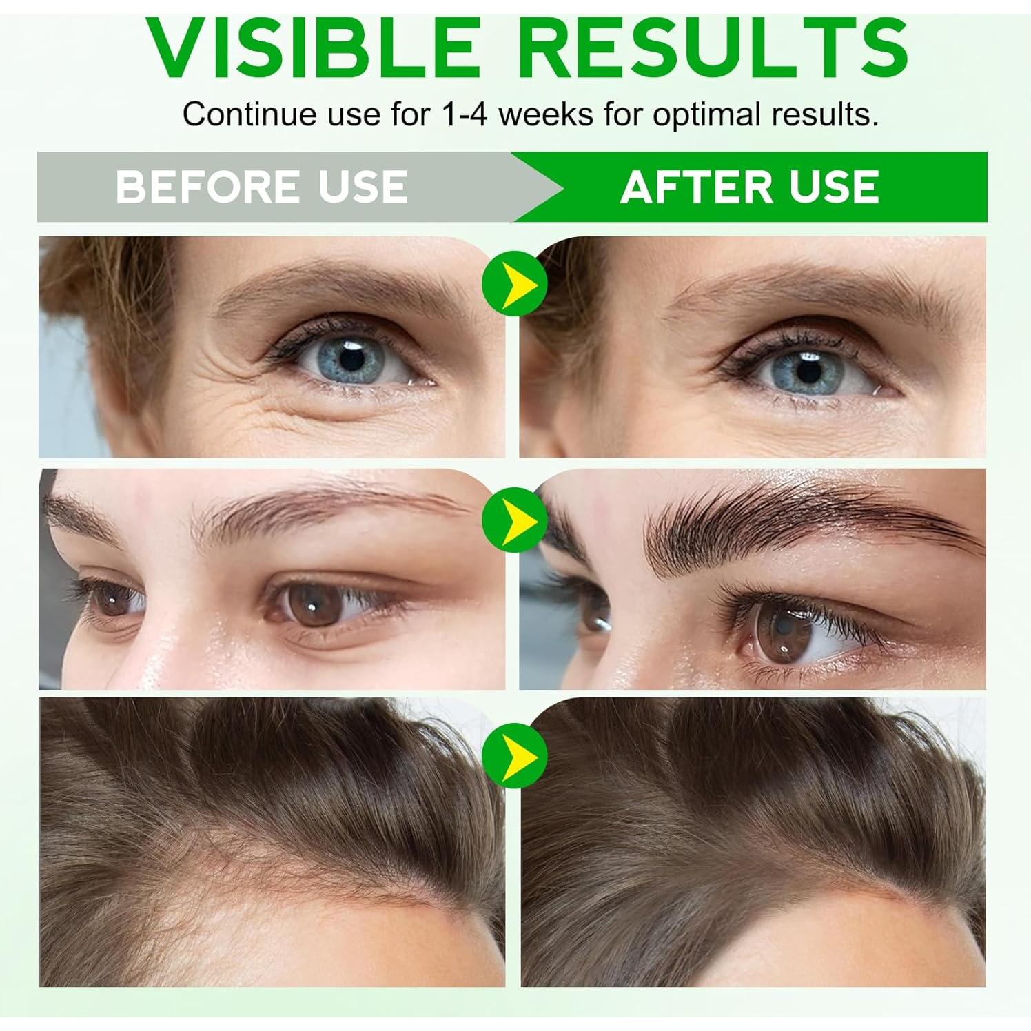 Aceite de Moringa Puro 60ml FSLHCY - Hidratante Facial y Capilar