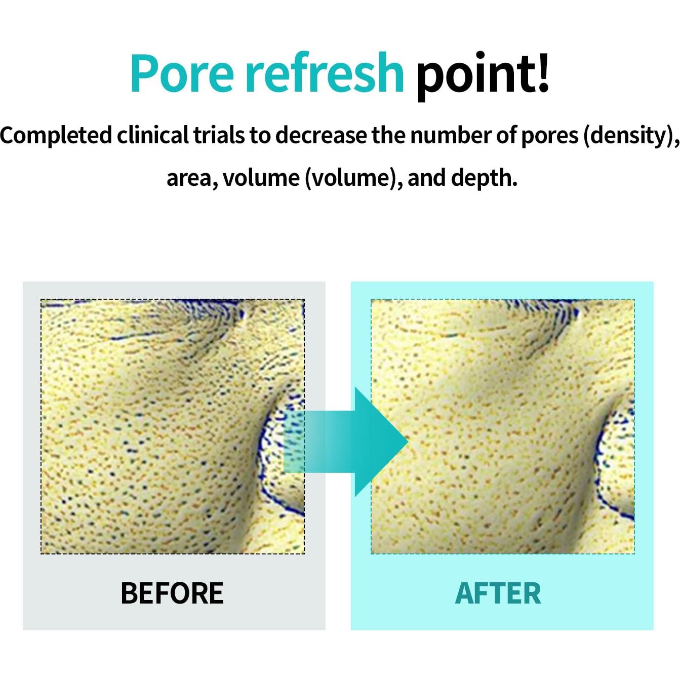 Sérum Astringente de Poros Ilso Moringa 30 ml - PHA