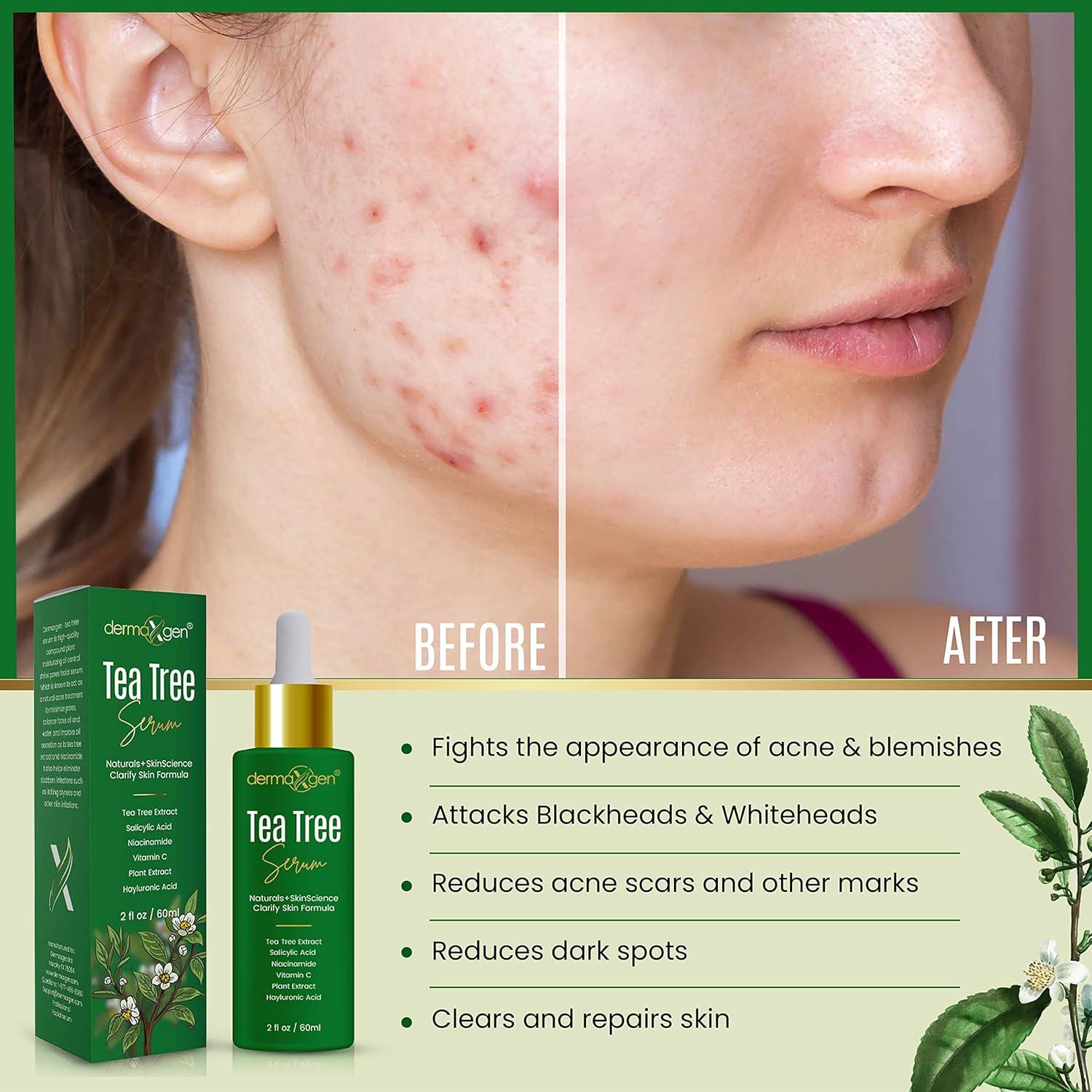 Suero Iluminador Orgánico Dermaxgen 60 ml - Aceite de Árbol de Té y Vitamina C