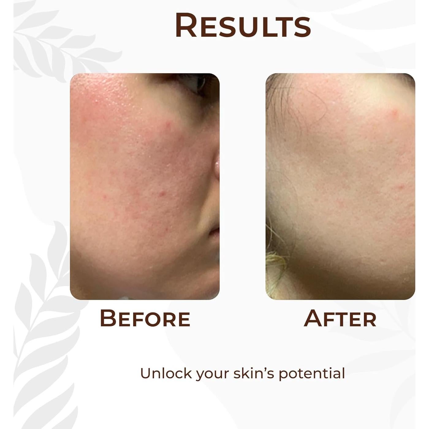 Aceite de Tratamiento Multiusos Beauty Edit 50 ml - Baobab y Melón Kalahari