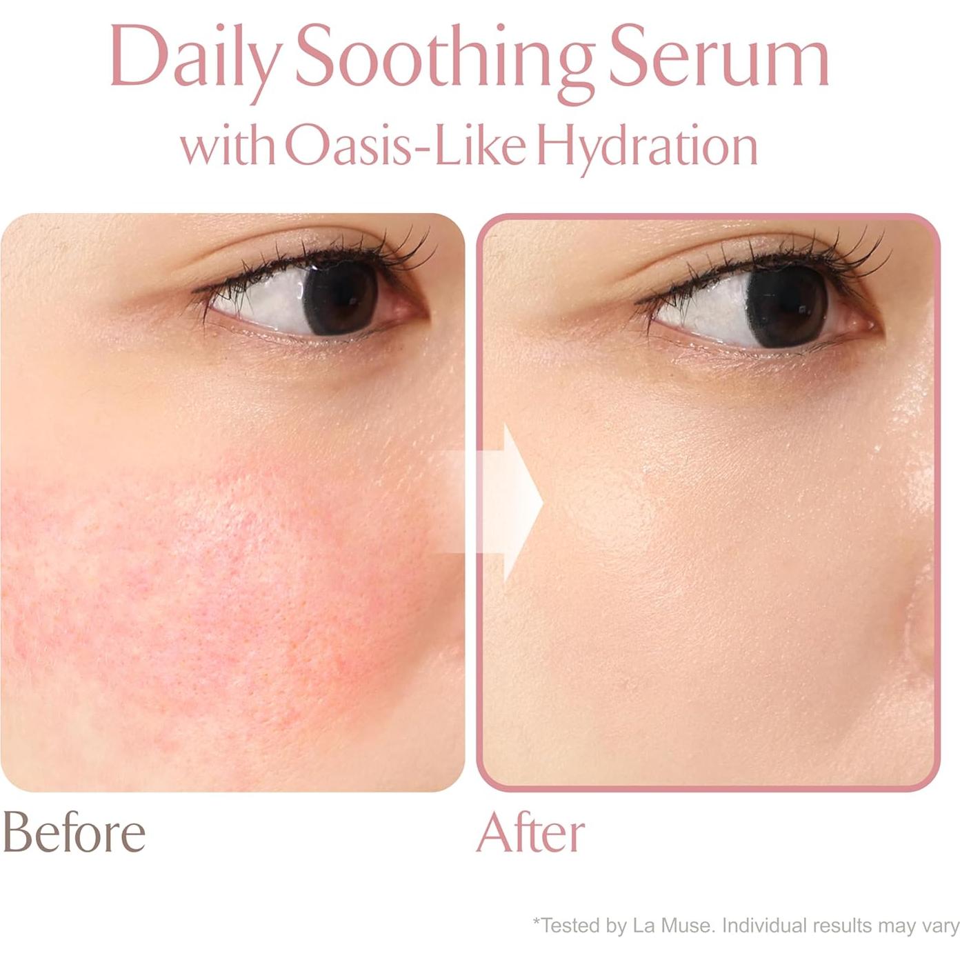 Suero Calmante LA MUSE Oasis 200 ml - Hidratación Intensiva