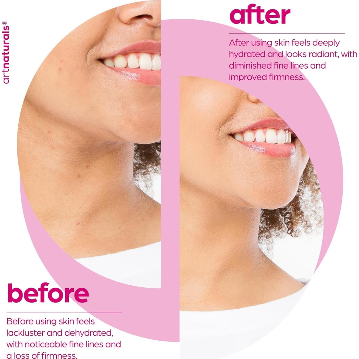 Suero Facial Antienvejecimiento Artnaturals 28.35 g - Colágeno