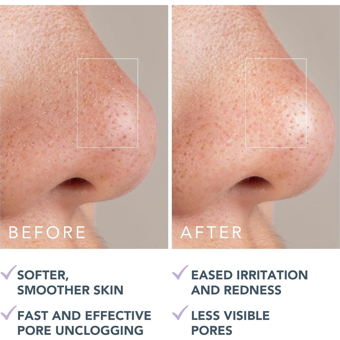 Máscara Facial Purificante FOREO KIWI 99 g - Removedor de Puntos Negros y Poros