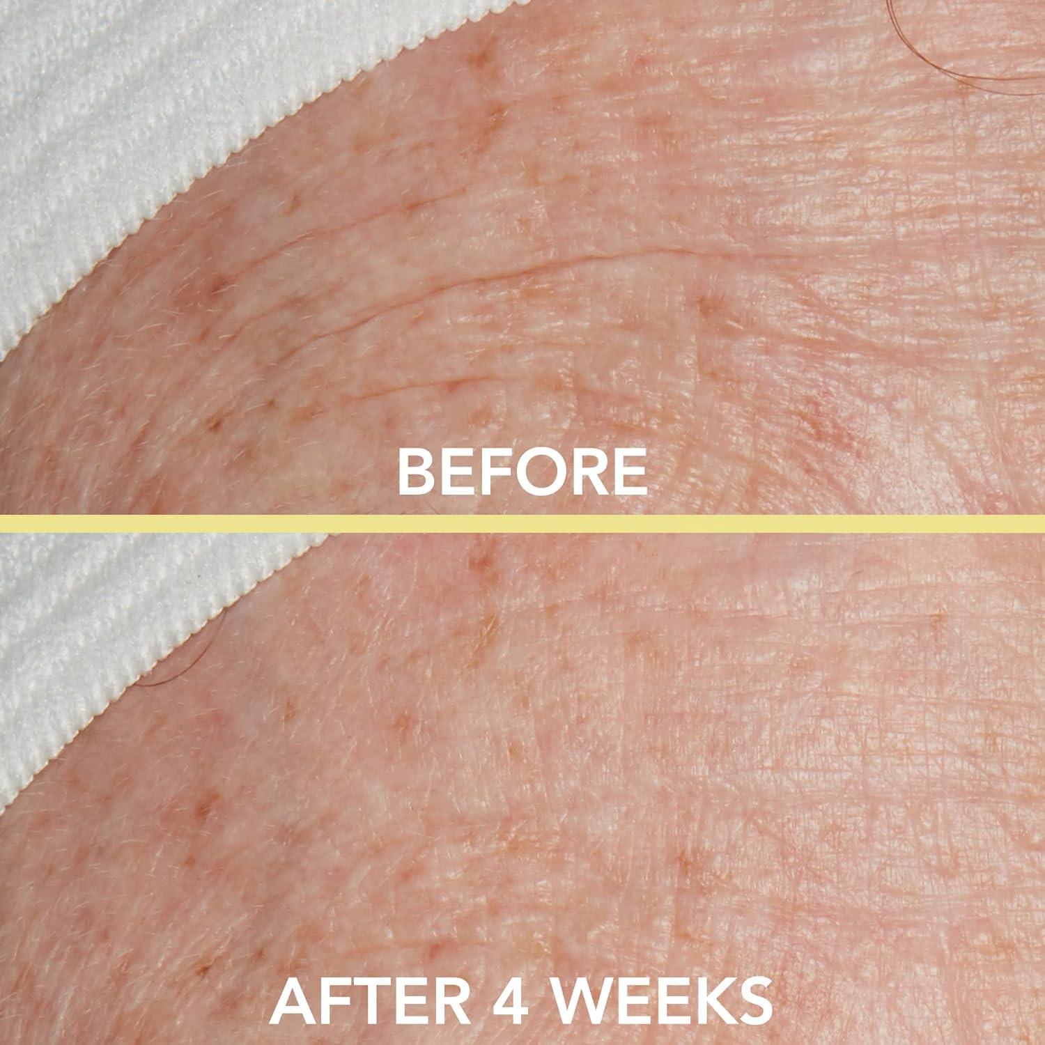 Suero Facial Antienvejecimiento Lancer 29.57 ml con Vitamina E