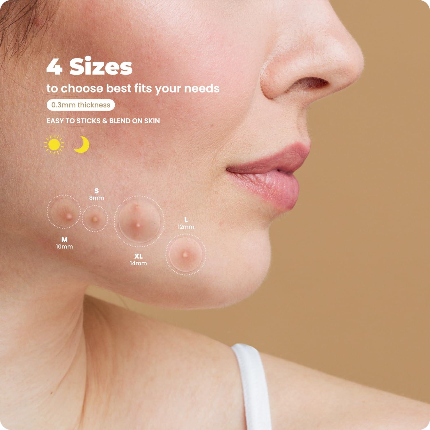 Parches para Granitos RoselynBoutique 300 Piezas Hidrocoloide