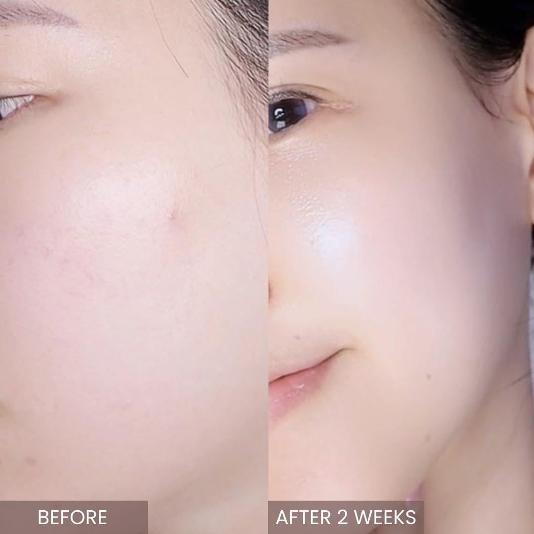 Crema Intensiva de Árbol de Té APLIN 50g - Hidratante Facial