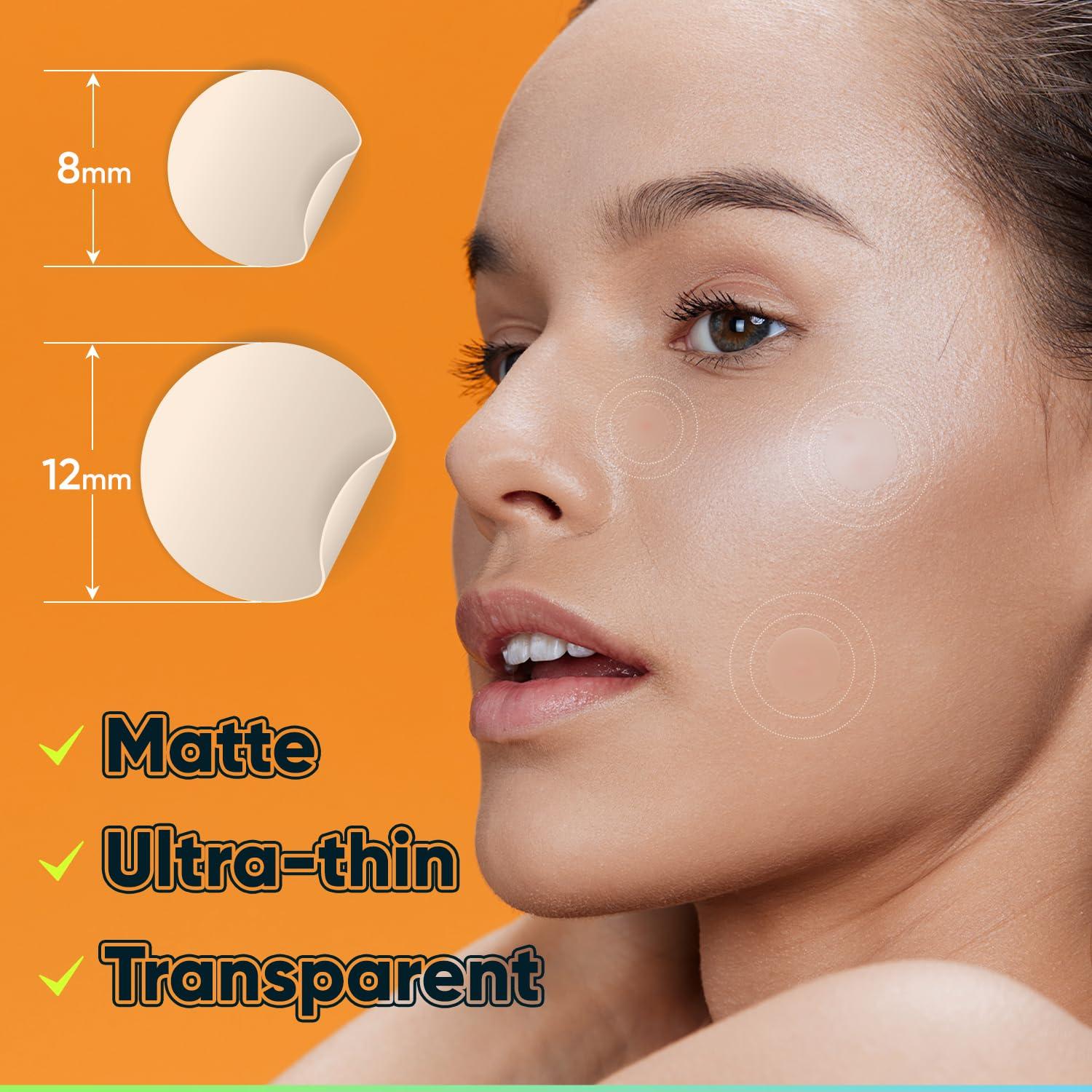 Parches Hidrocoloides para Granos BIORICA 216 Pcs con Aceite de Árbol de Té