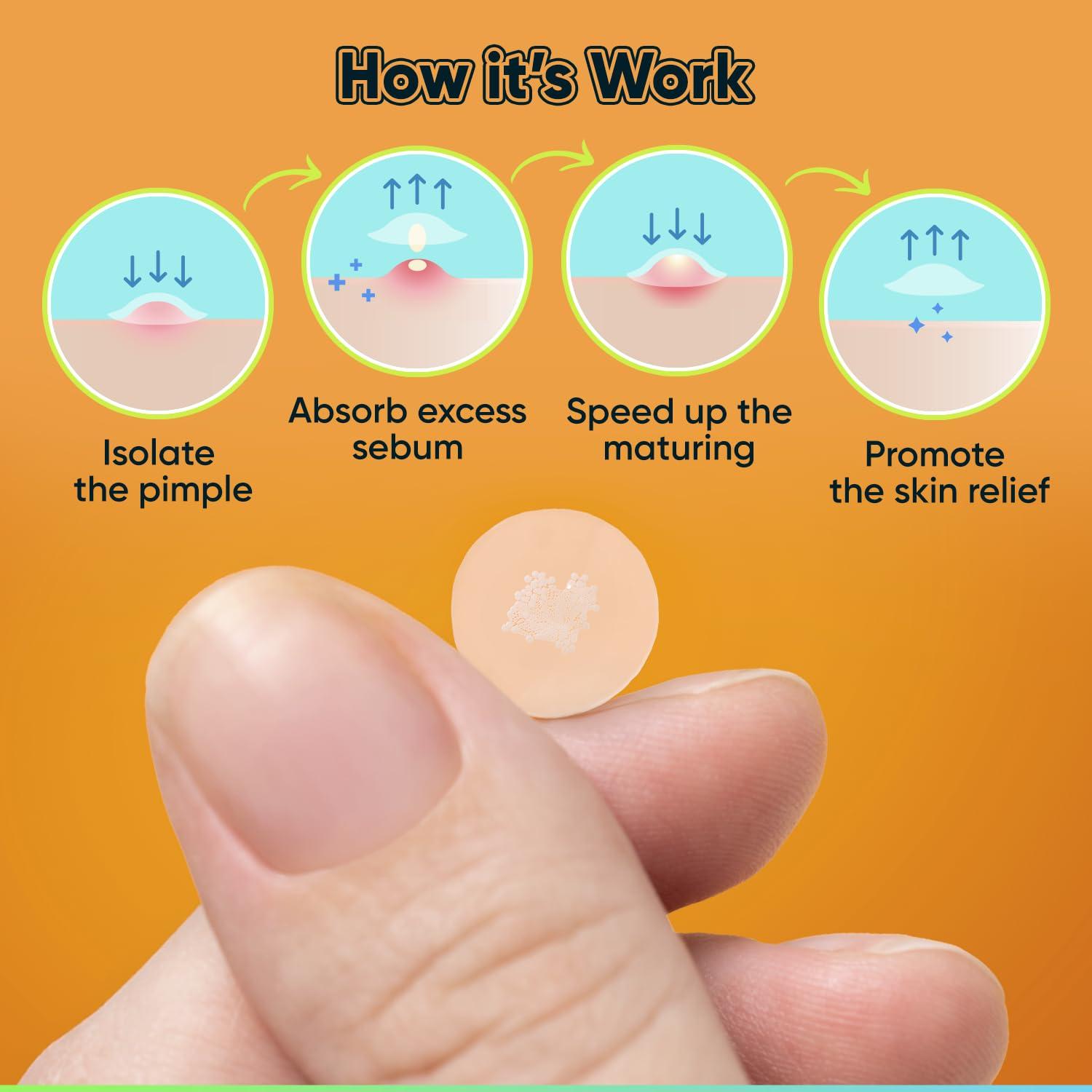 Parches Hidrocoloides para Granos BIORICA 216 Pcs con Aceite de Árbol de Té