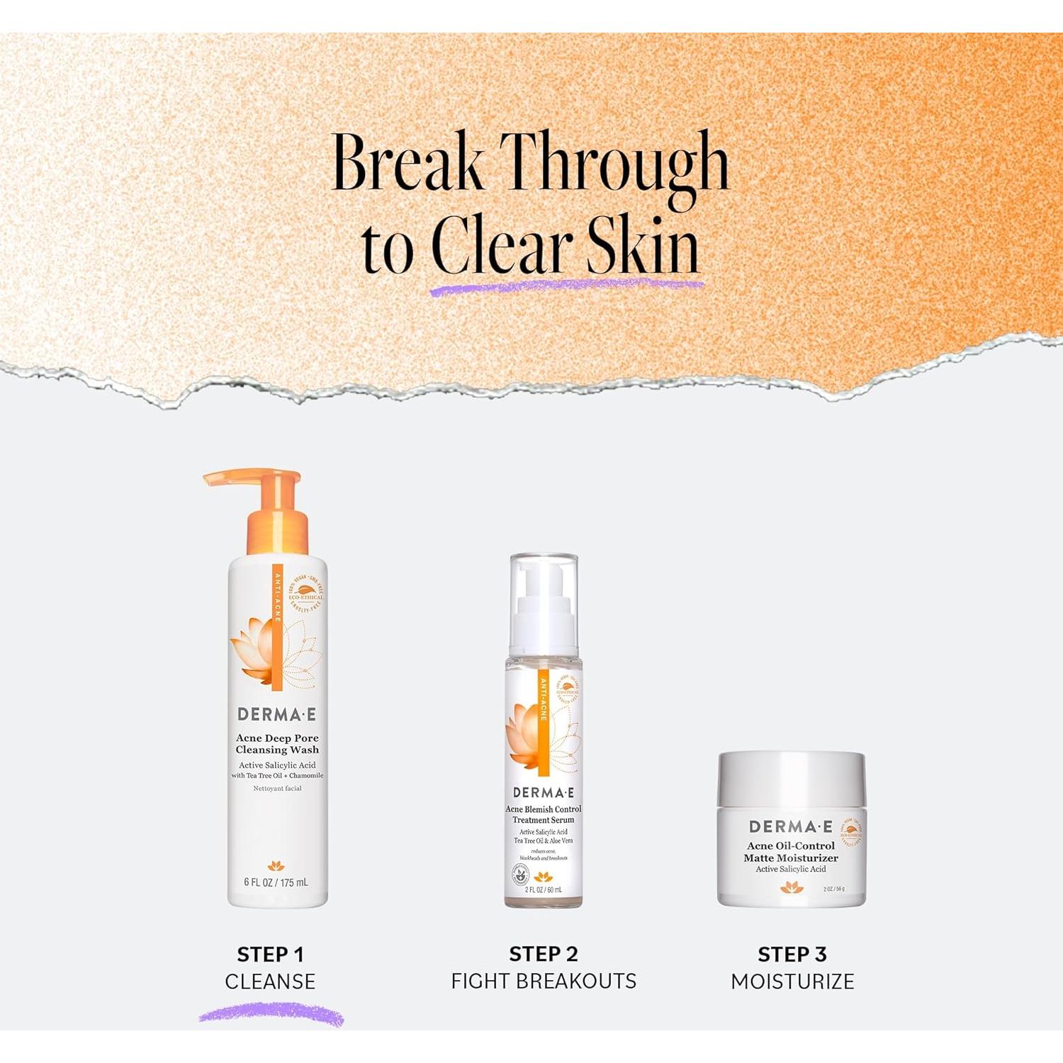 Limpiador Facial Derma E 177 ml - Control Acné con Ácido Salicílico