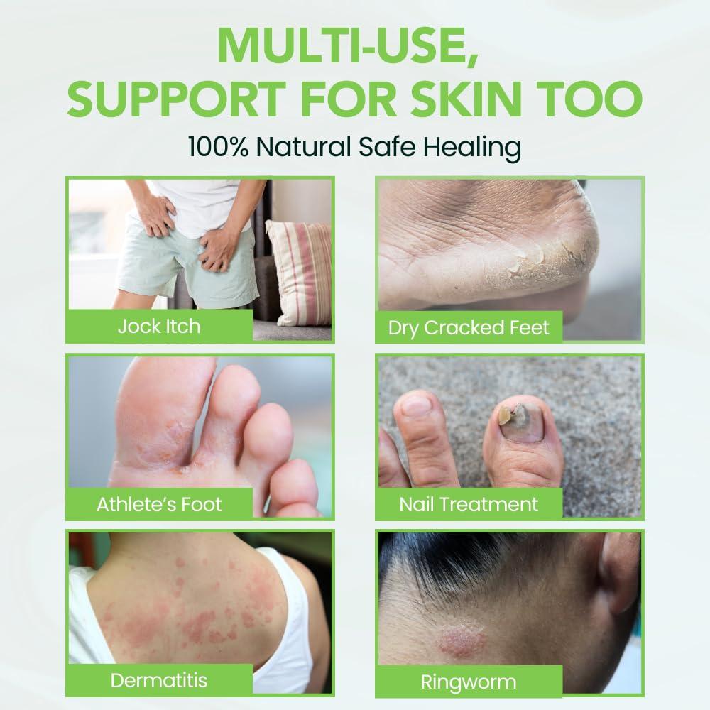 Bálsamo para Pies de Atleta THENA 140g - Alivio Rápido y Hidratación