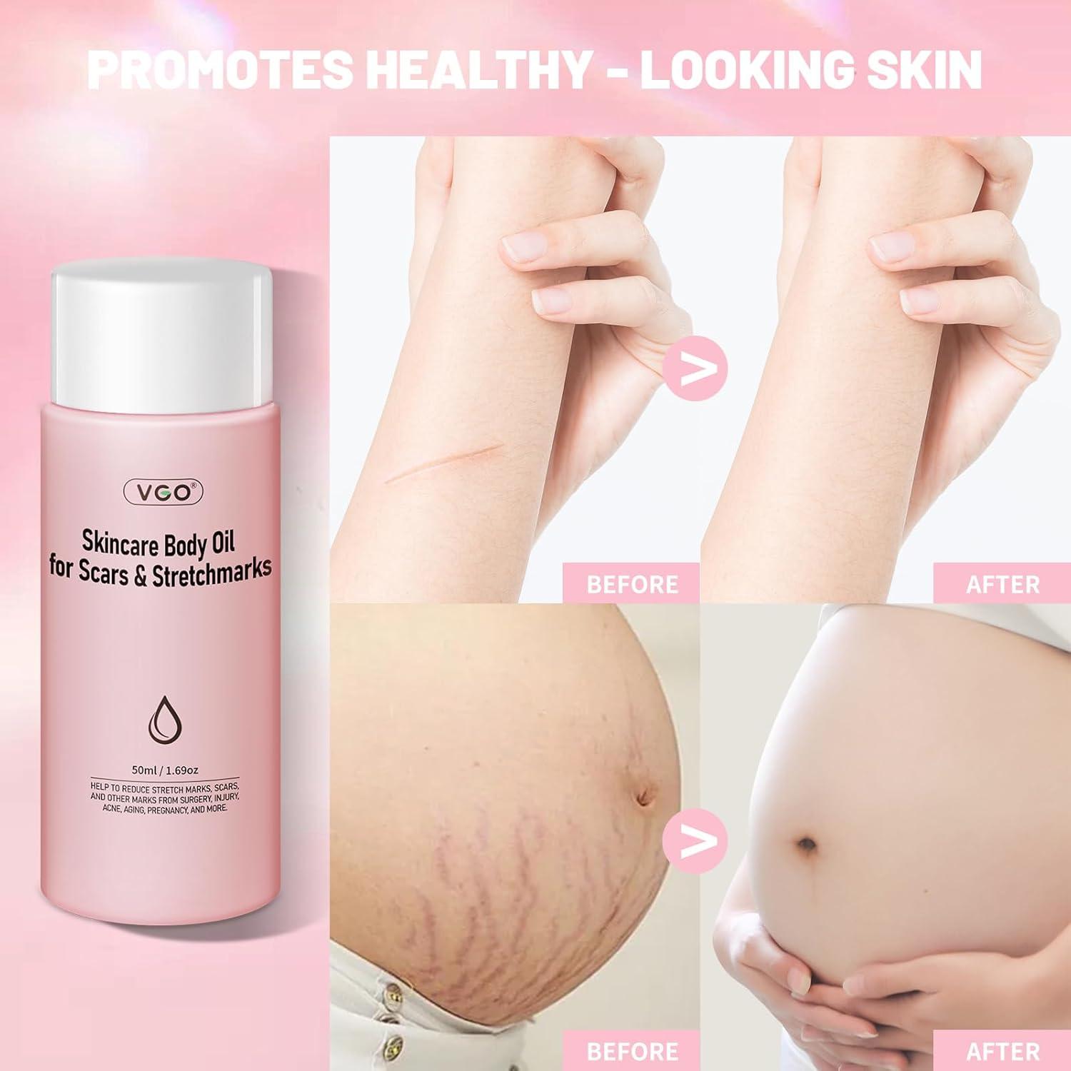 Aceite Corporal VGO 120 ml con Vitamina E Hidratante para Piel Seca