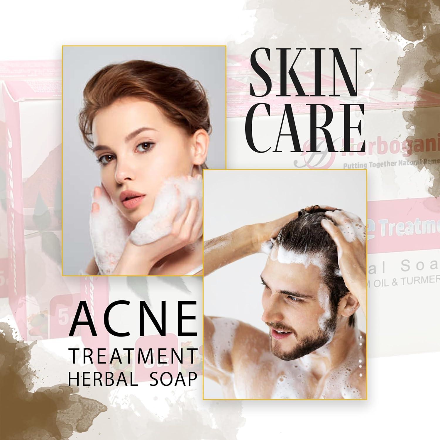 Jabón Herbal Herboganic de Neem y Cúrcuma 141.75g