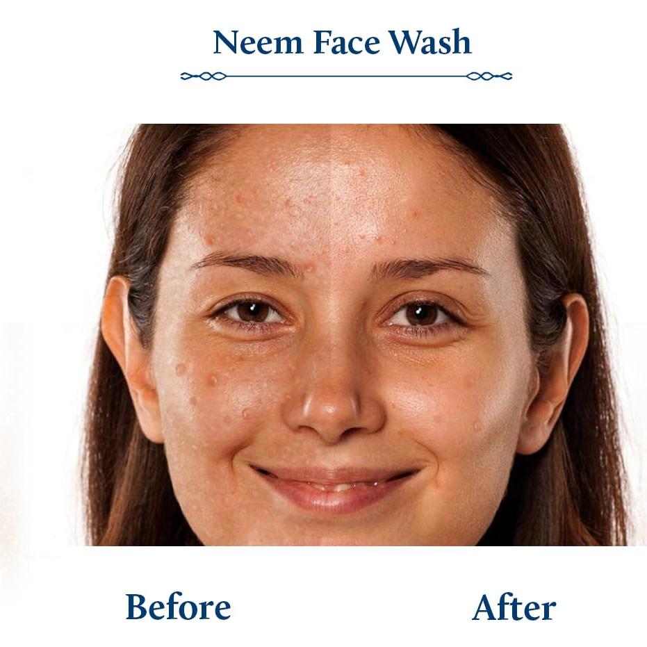 Limpiador Facial Blue Nectar 100 ml con Vitamina C y Neem